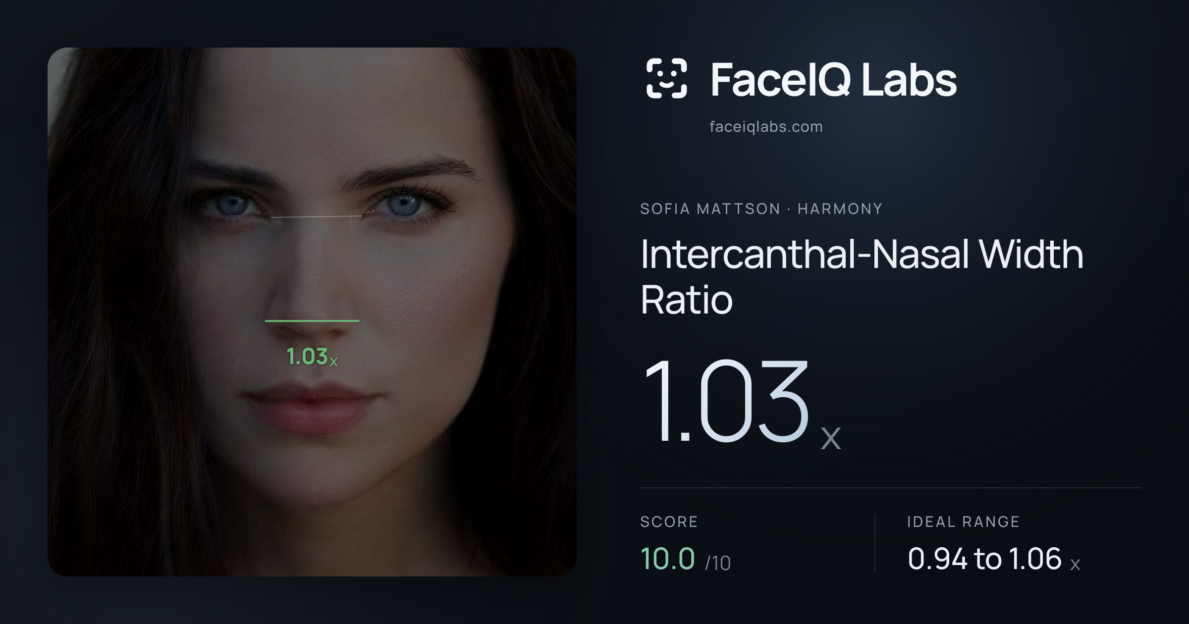 Sofia Mattson Intercanthal-Nasal Width Ratio: 1.03x, drawn on the photo