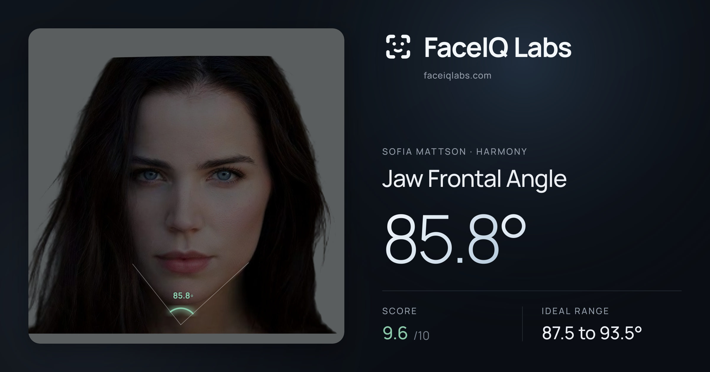 Sofia Mattson Jaw Frontal Angle: 85.8°, drawn on the photo
