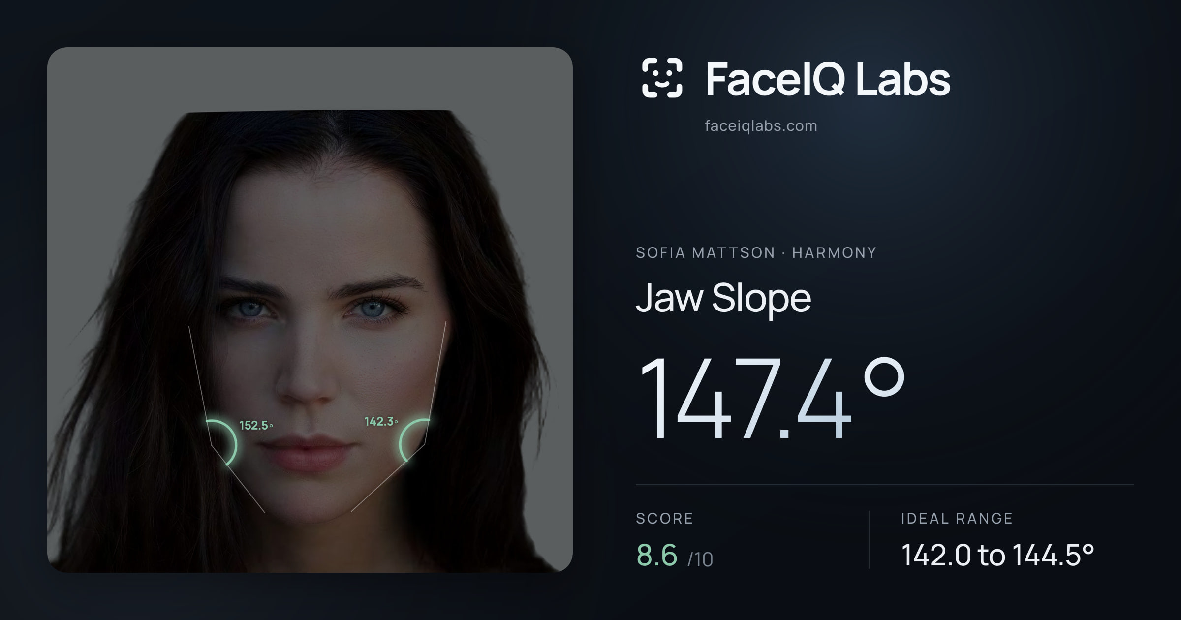Sofia Mattson Jaw Slope: 147.4°, drawn on the photo
