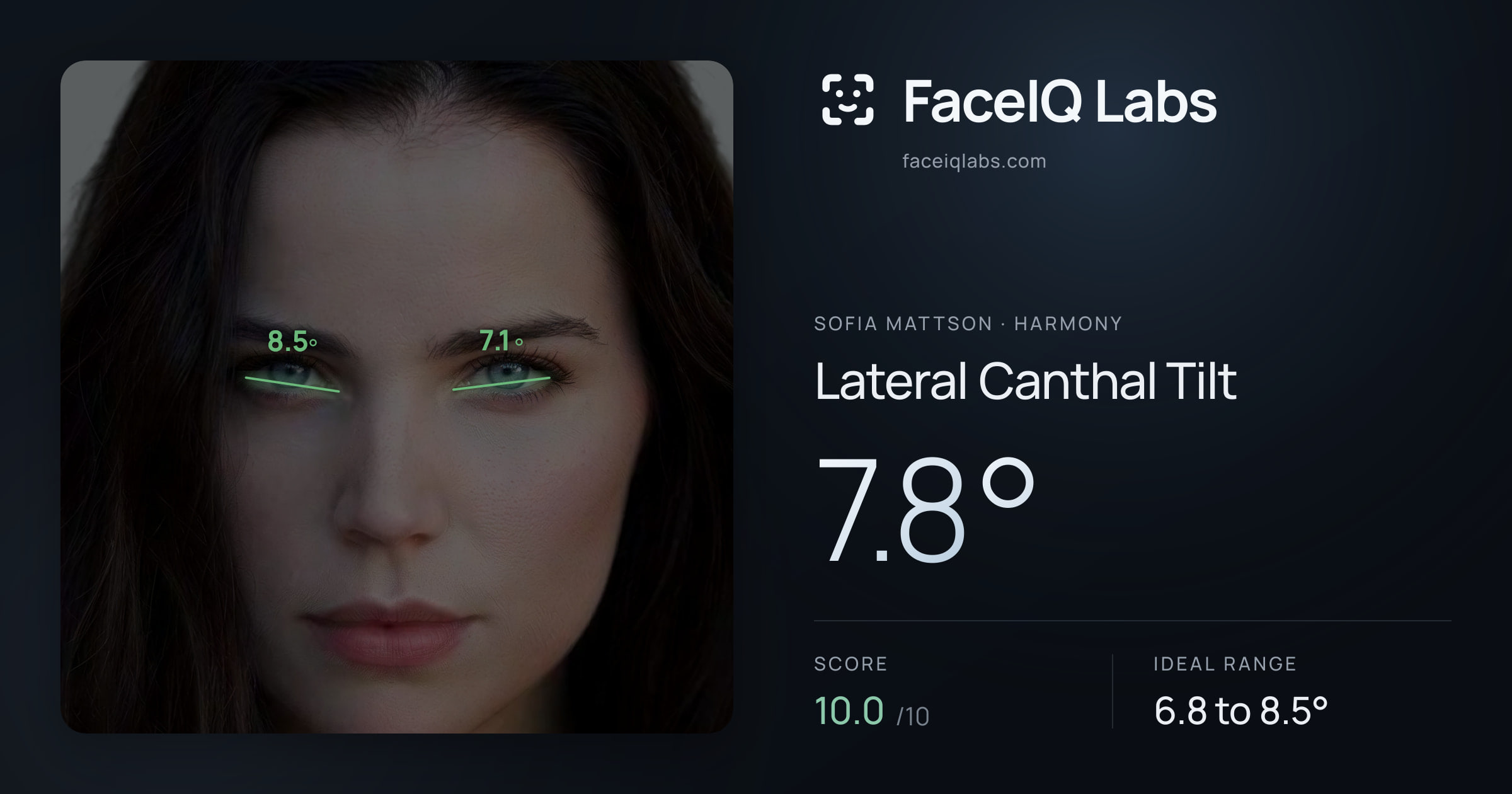 Sofia Mattson Lateral Canthal Tilt: 7.8°, drawn on the photo
