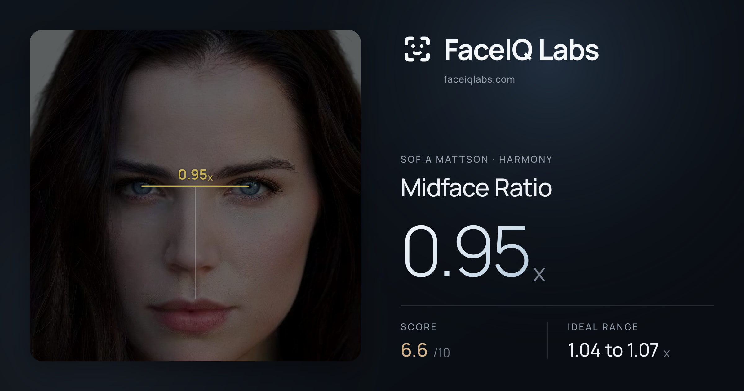 Sofia Mattson Midface Ratio: 0.95x, drawn on the photo