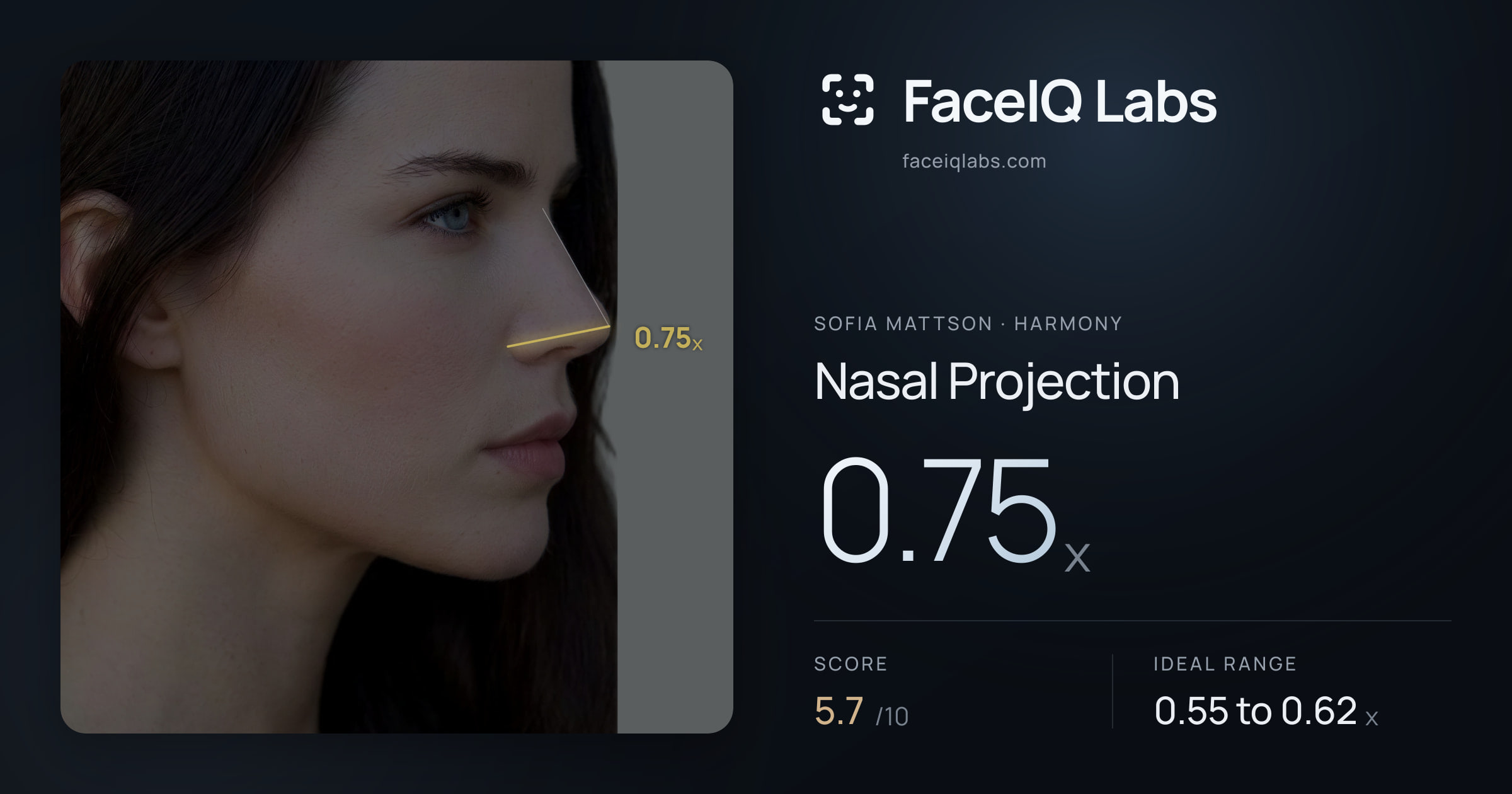 Sofia Mattson Nasal Projection: 0.75x, drawn on the photo