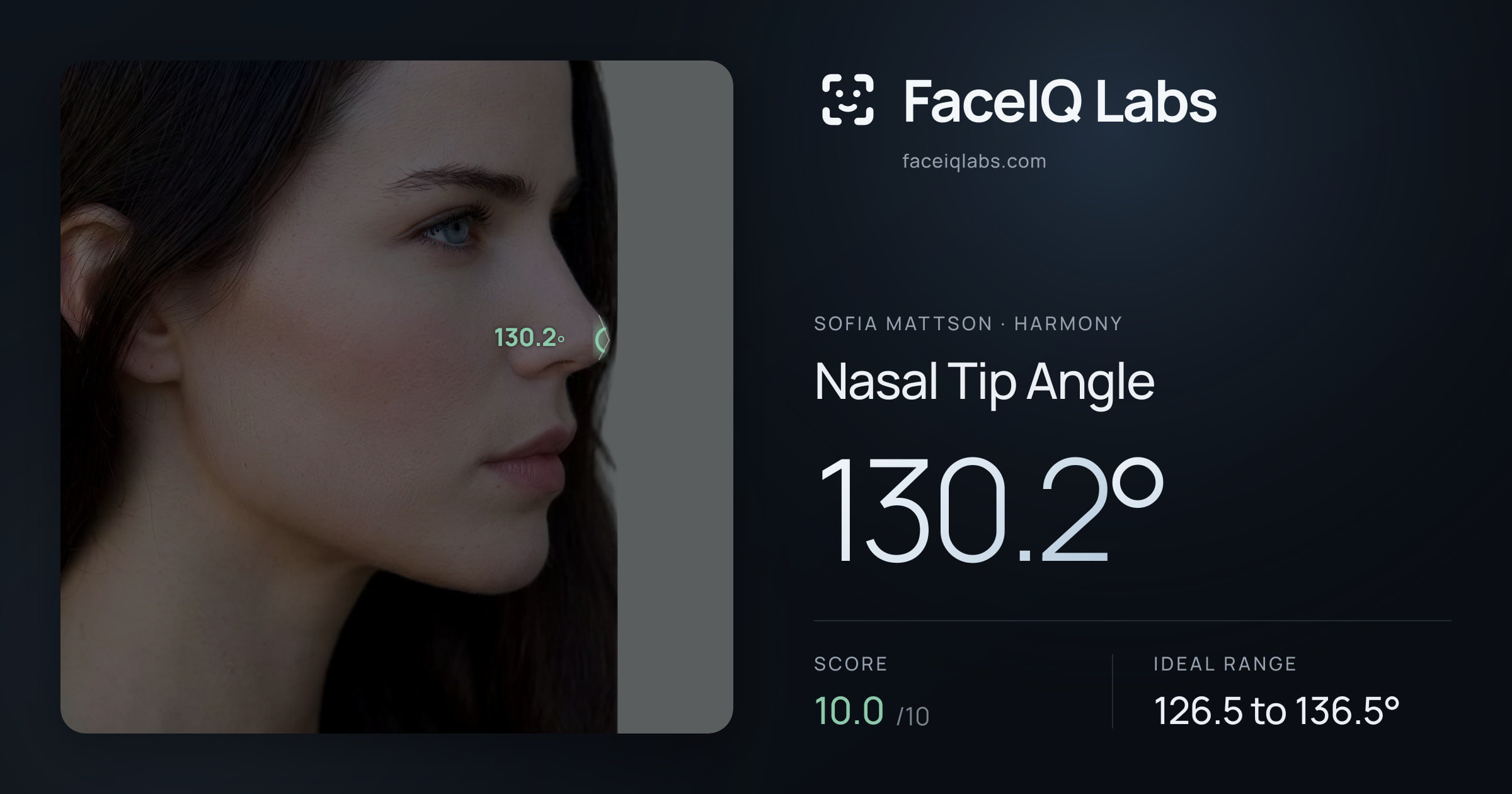 Sofia Mattson Nasal Tip Angle: 130.2°, drawn on the photo