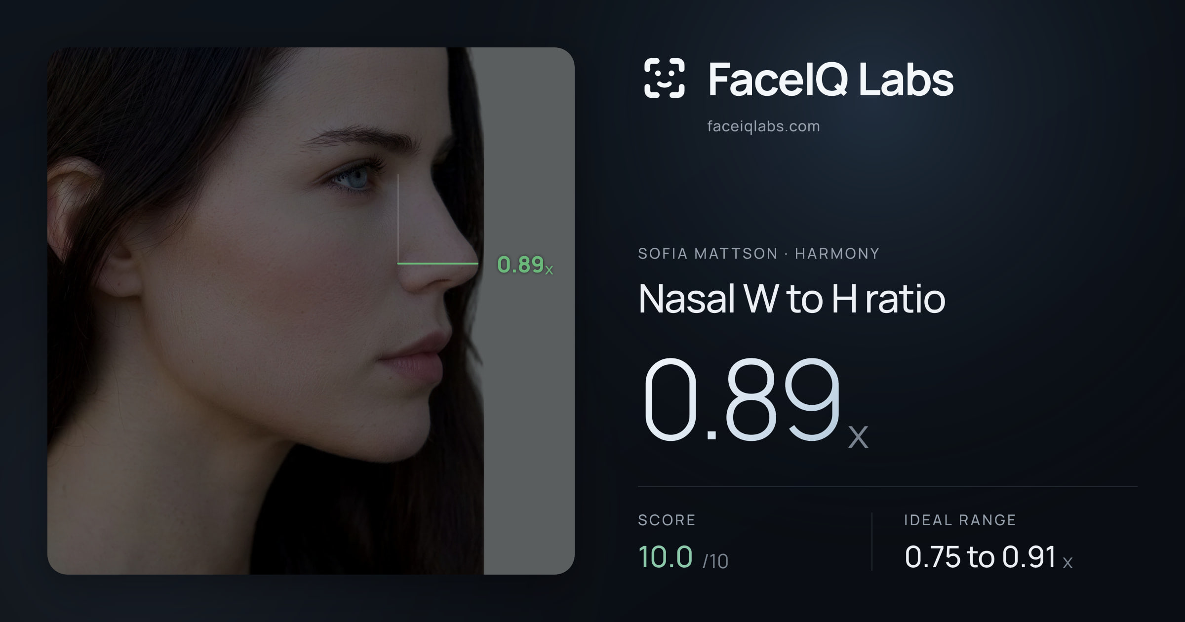 Sofia Mattson Nasal W to H ratio: 0.89x, drawn on the photo
