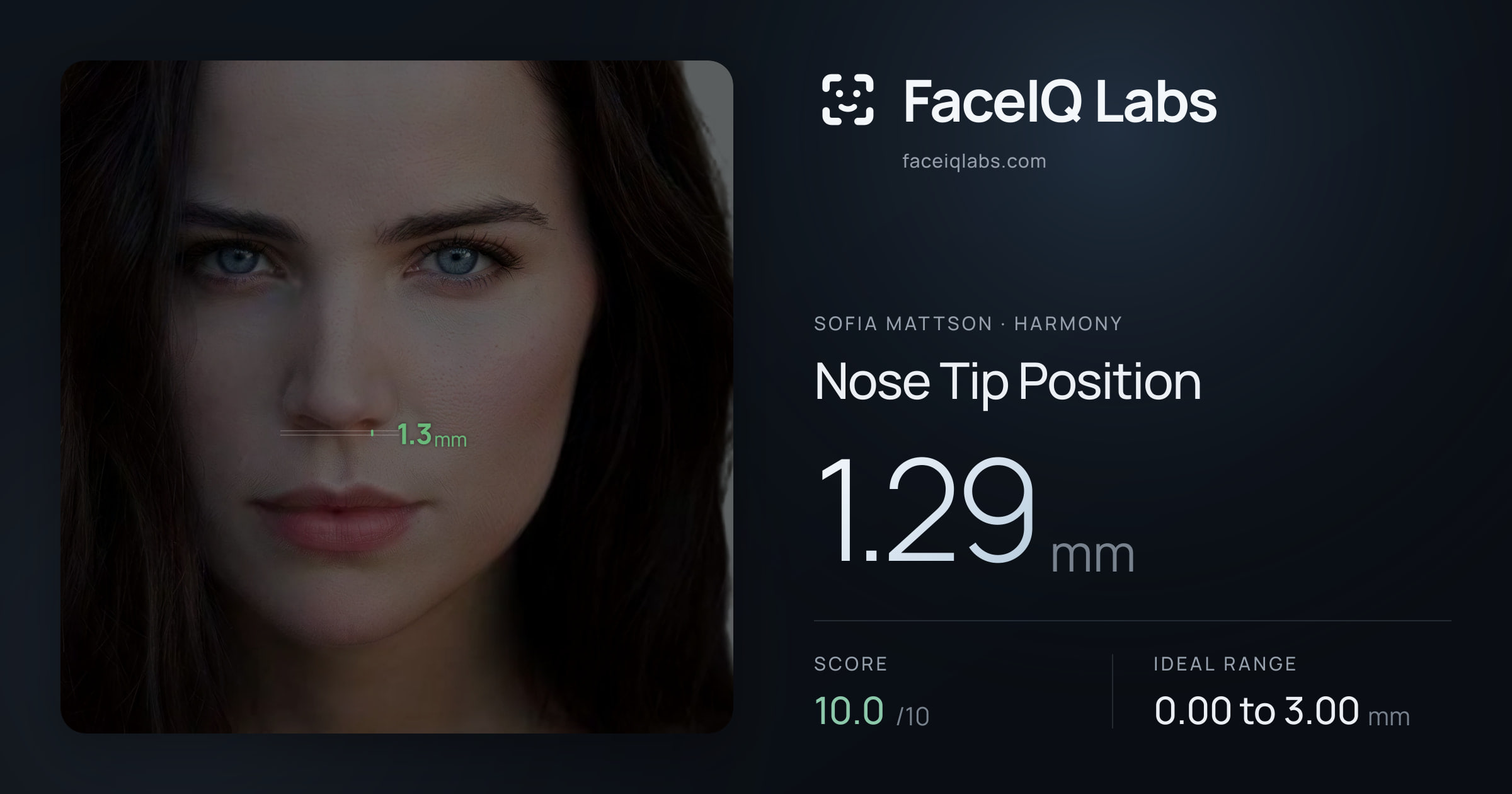 Sofia Mattson Nose Tip Position: 1.29mm, drawn on the photo