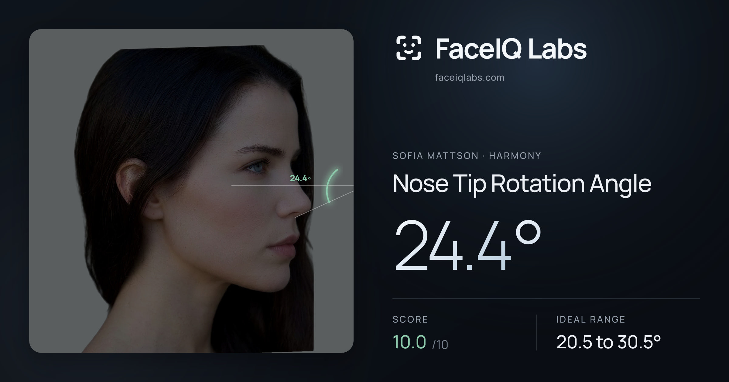 Sofia Mattson Nose Tip Rotation Angle: 24.4°, drawn on the photo