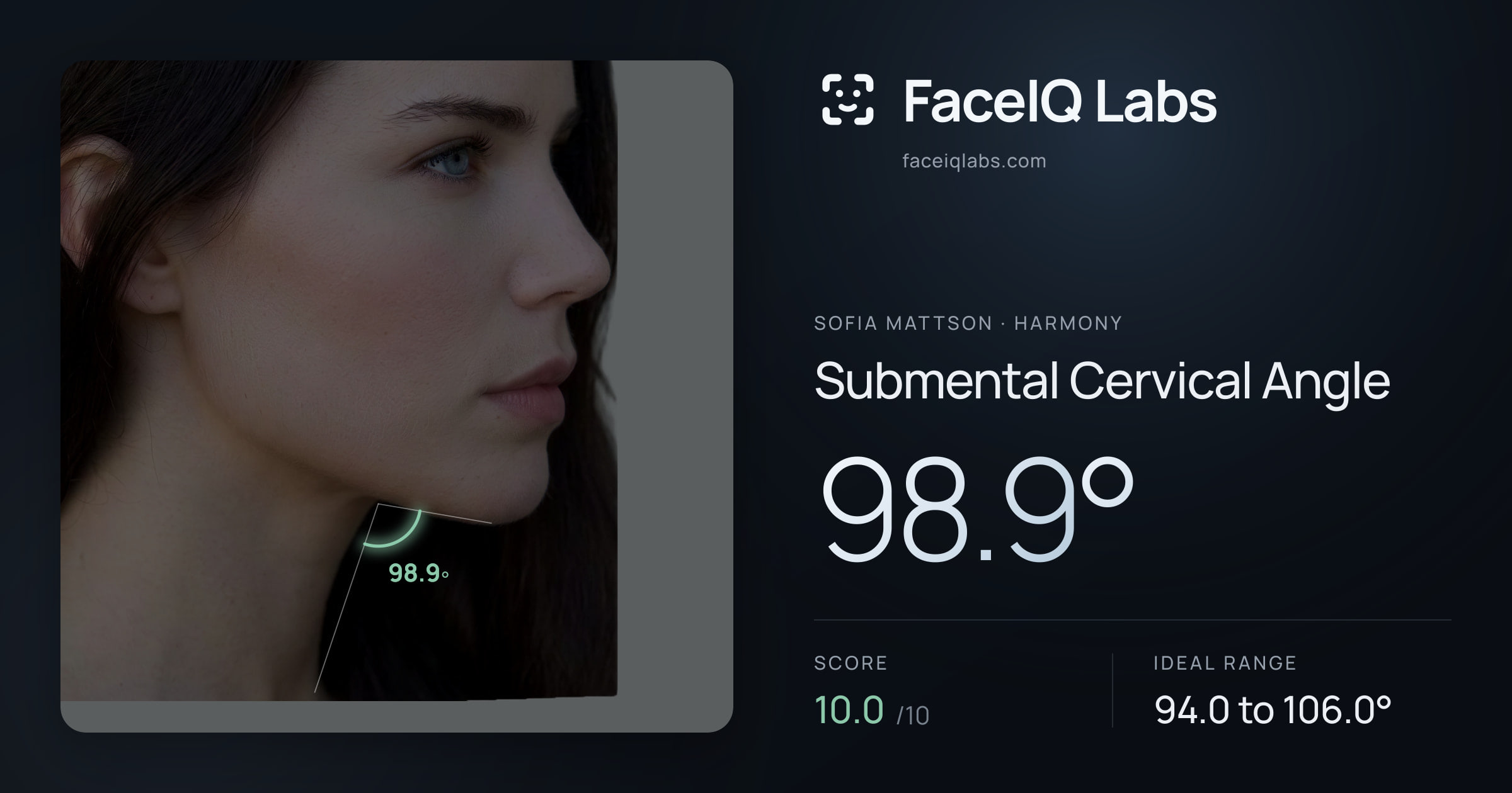 Sofia Mattson Submental Cervical Angle: 98.9°, drawn on the photo