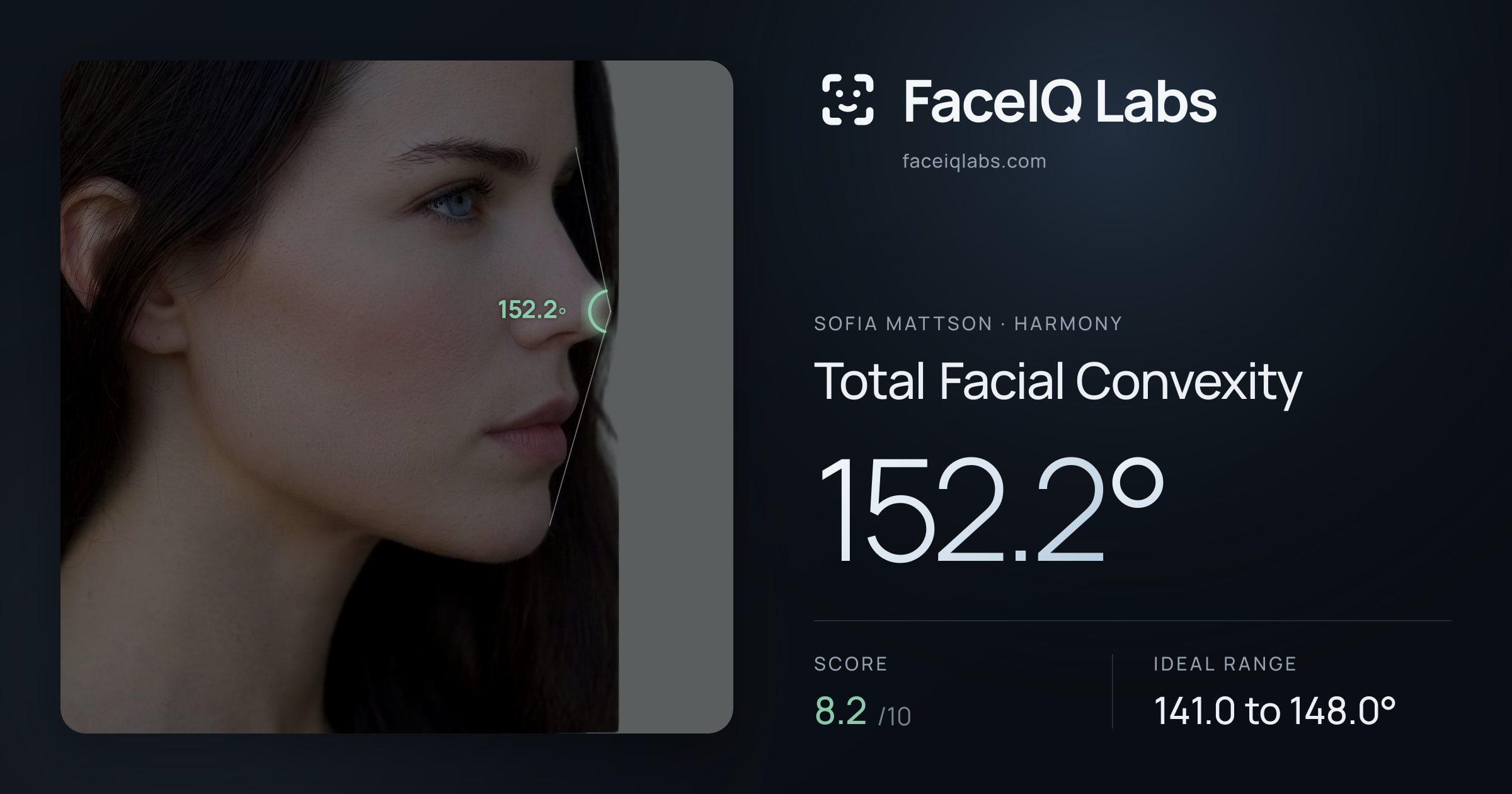 Sofia Mattson Total Facial Convexity: 152.2°, drawn on the photo