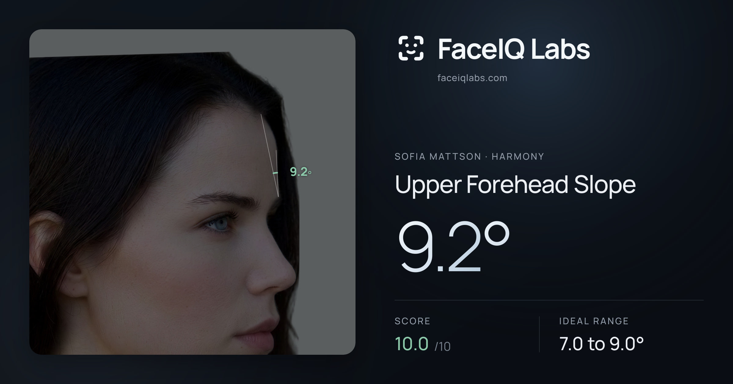 Sofia Mattson Upper Forehead Slope: 9.2°, drawn on the photo