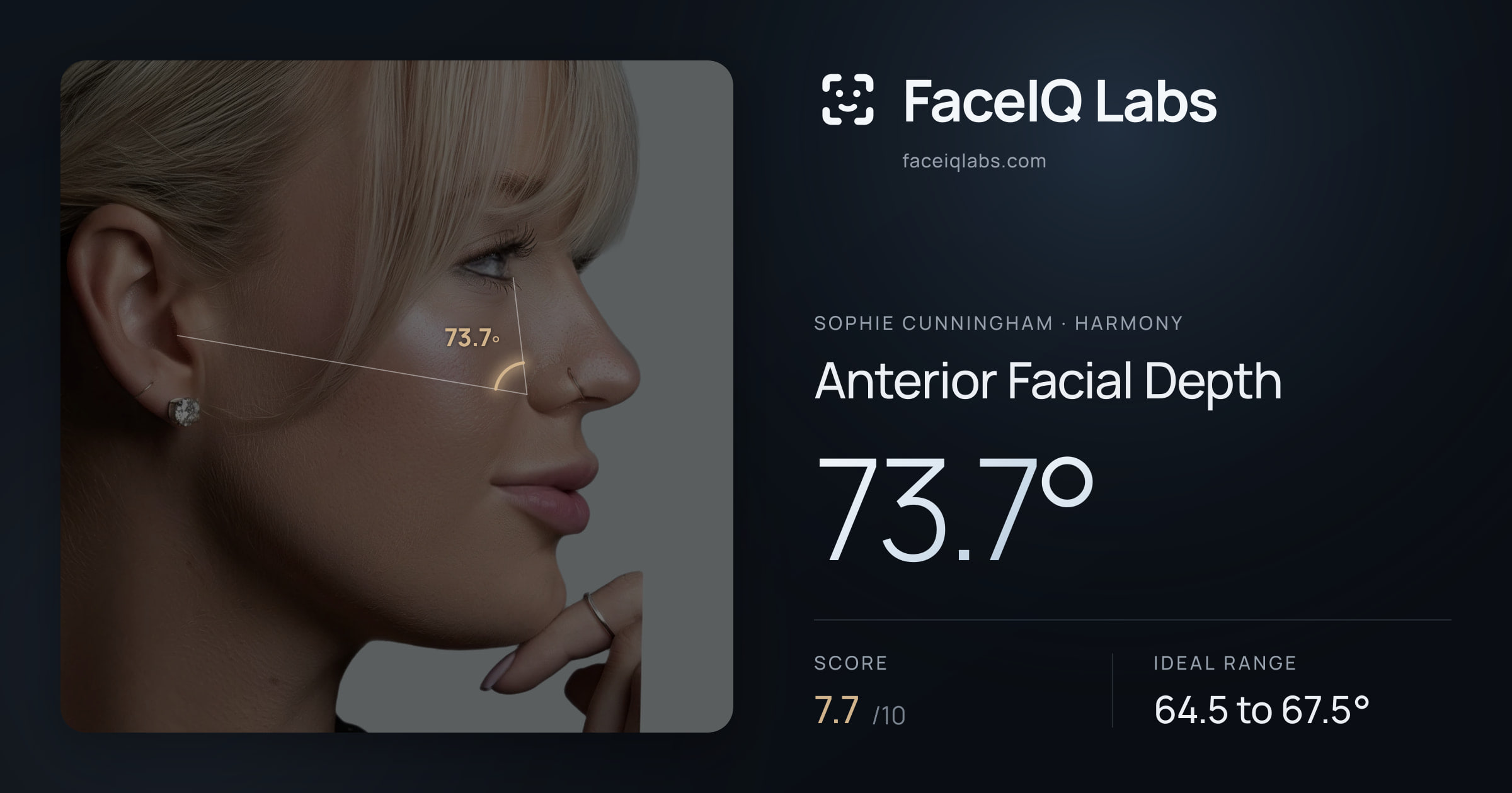 Sophie Cunningham Anterior Facial Depth: 73.7°, drawn on the photo