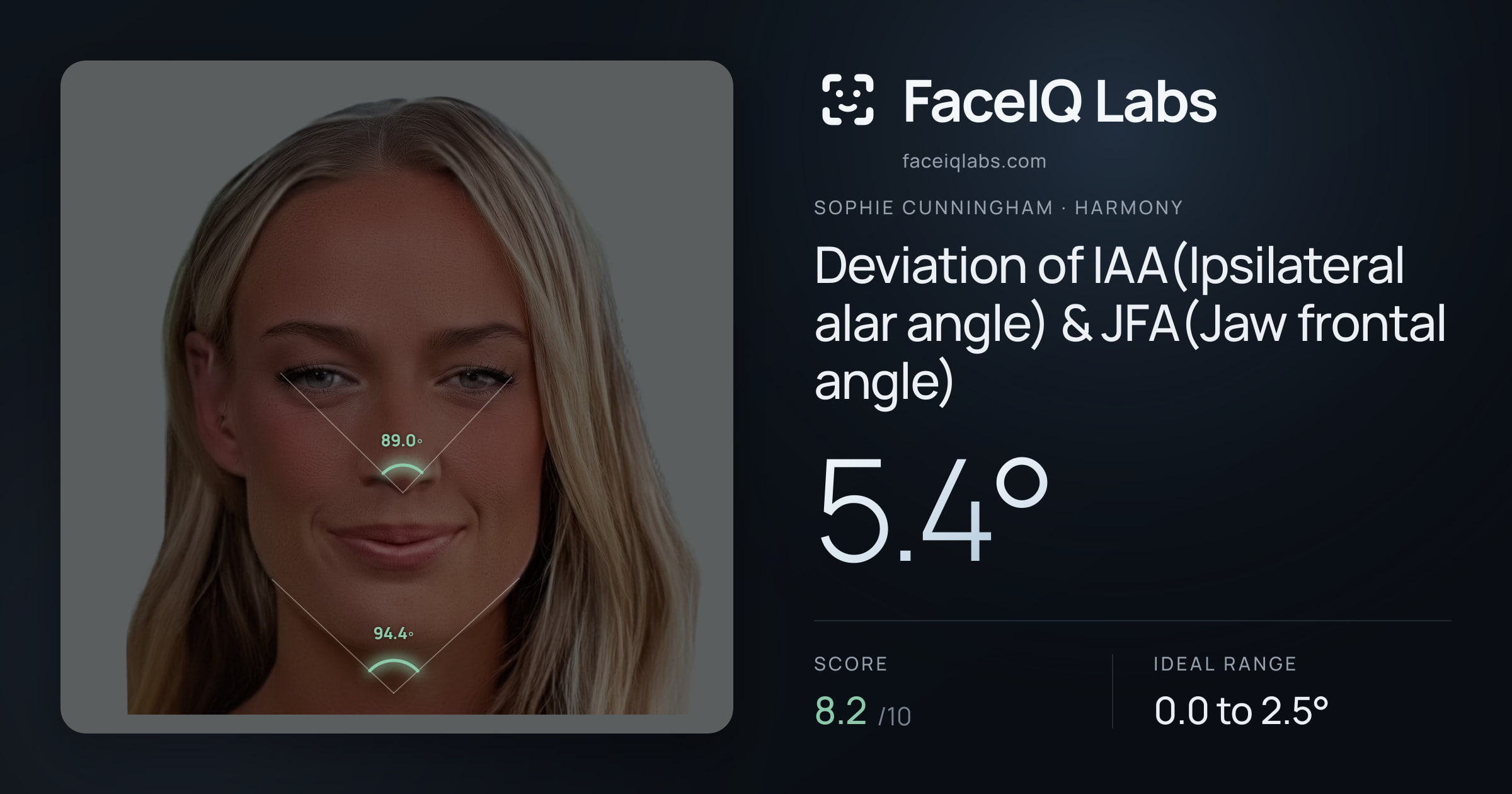 Sophie Cunningham Deviation of IAA(Ipsilateral alar angle) & JFA(Jaw frontal angle): 5.4°, drawn on the photo