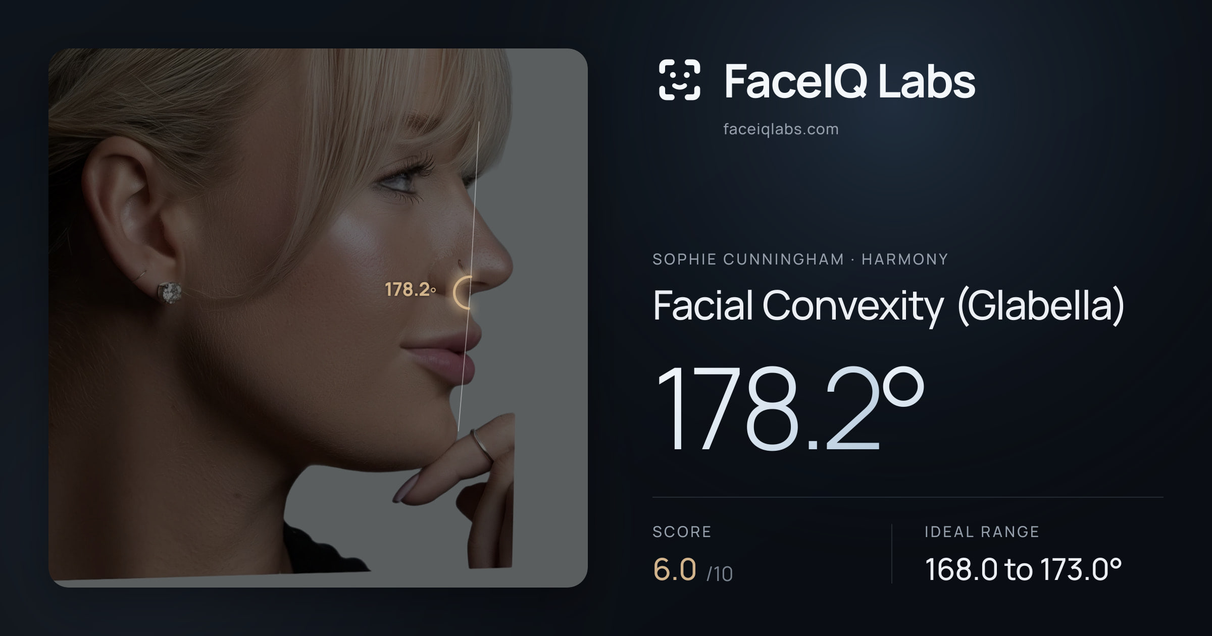 Sophie Cunningham Facial Convexity (Glabella): 178.2°, drawn on the photo