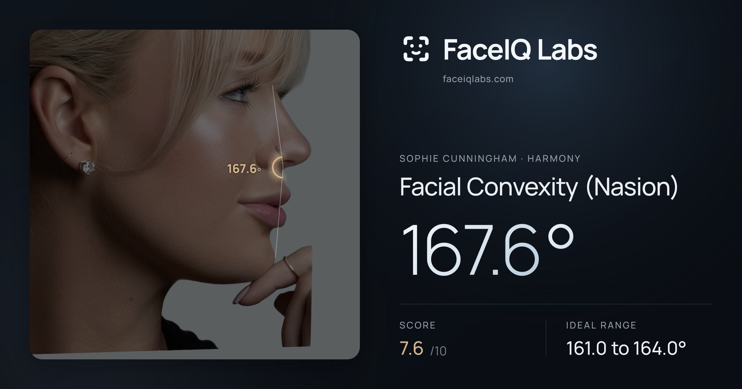 Sophie Cunningham Facial Convexity (Nasion): 167.6°, drawn on the photo