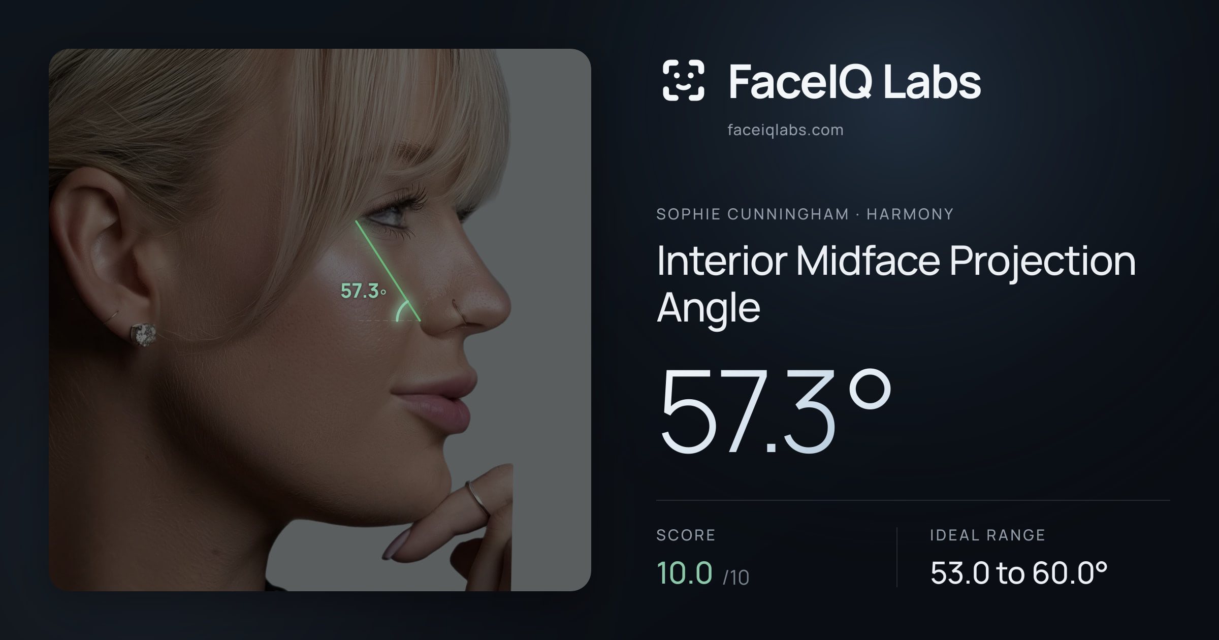 Sophie Cunningham Interior Midface Projection Angle: 57.3°, drawn on the photo