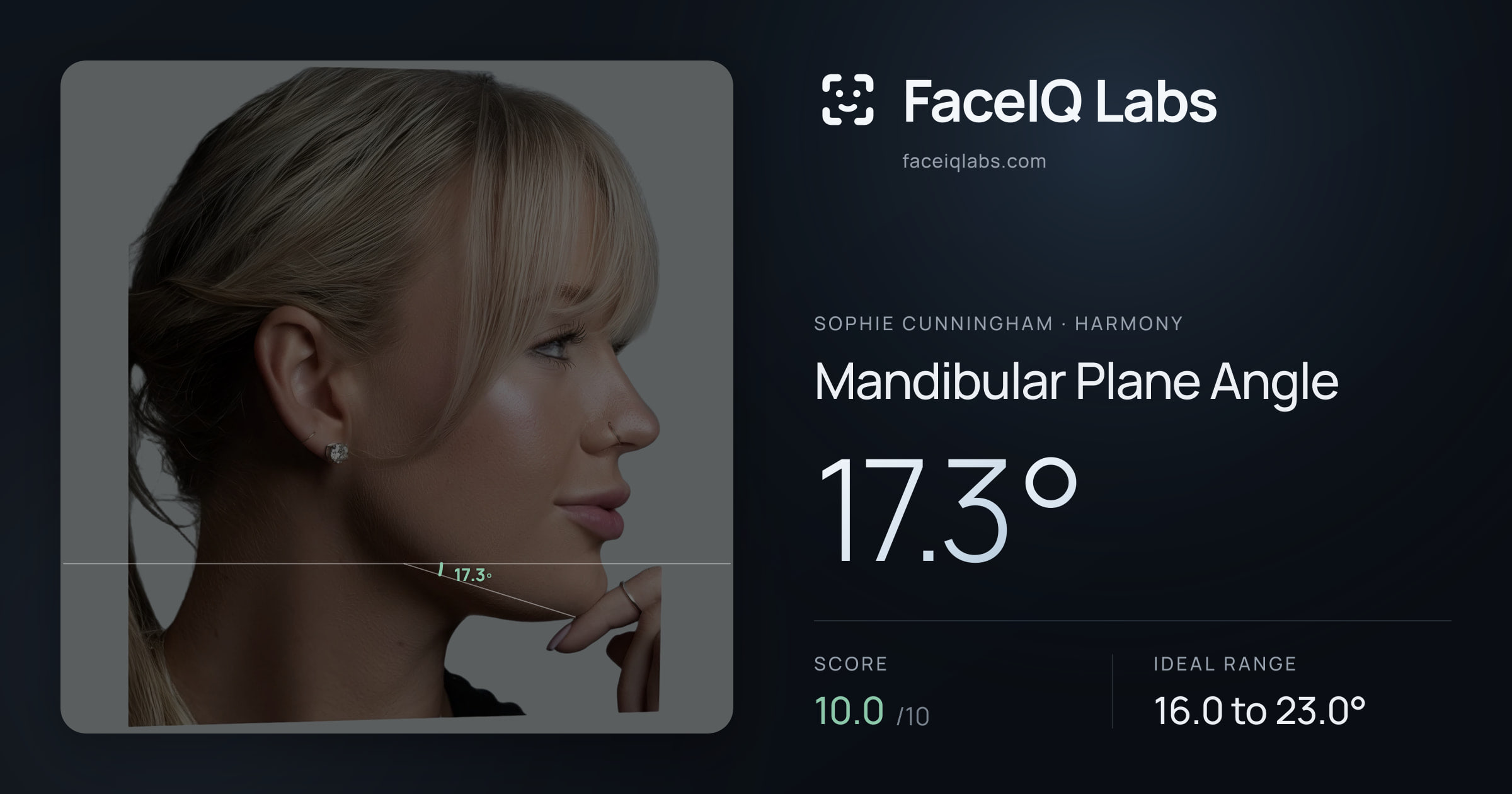 Sophie Cunningham Mandibular Plane Angle: 17.3°, drawn on the photo
