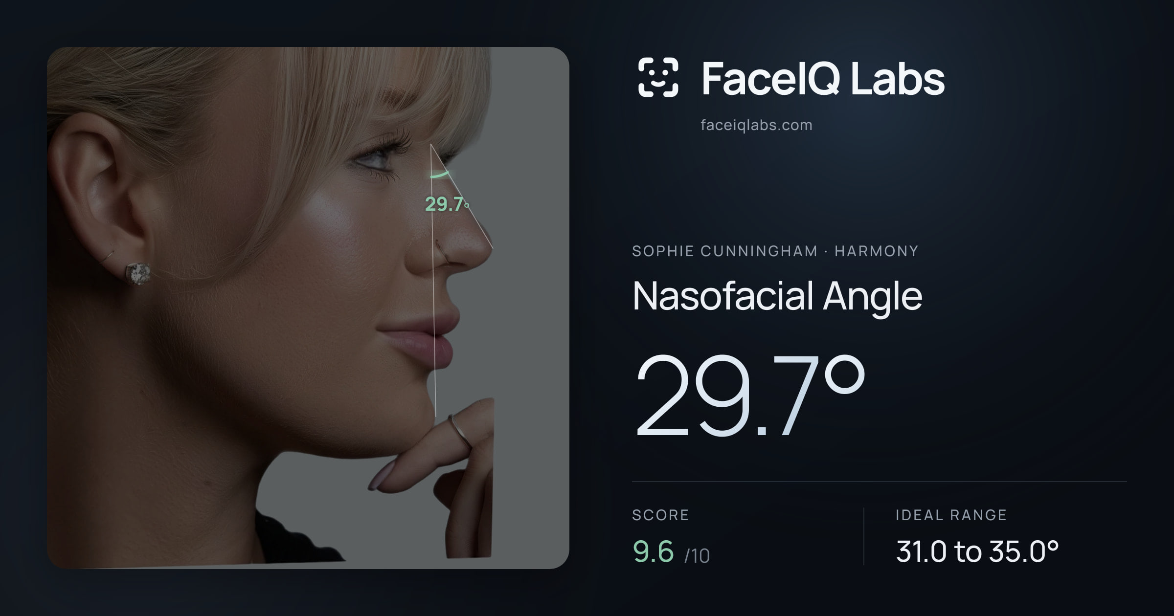 Sophie Cunningham Nasofacial Angle: 29.7°, drawn on the photo