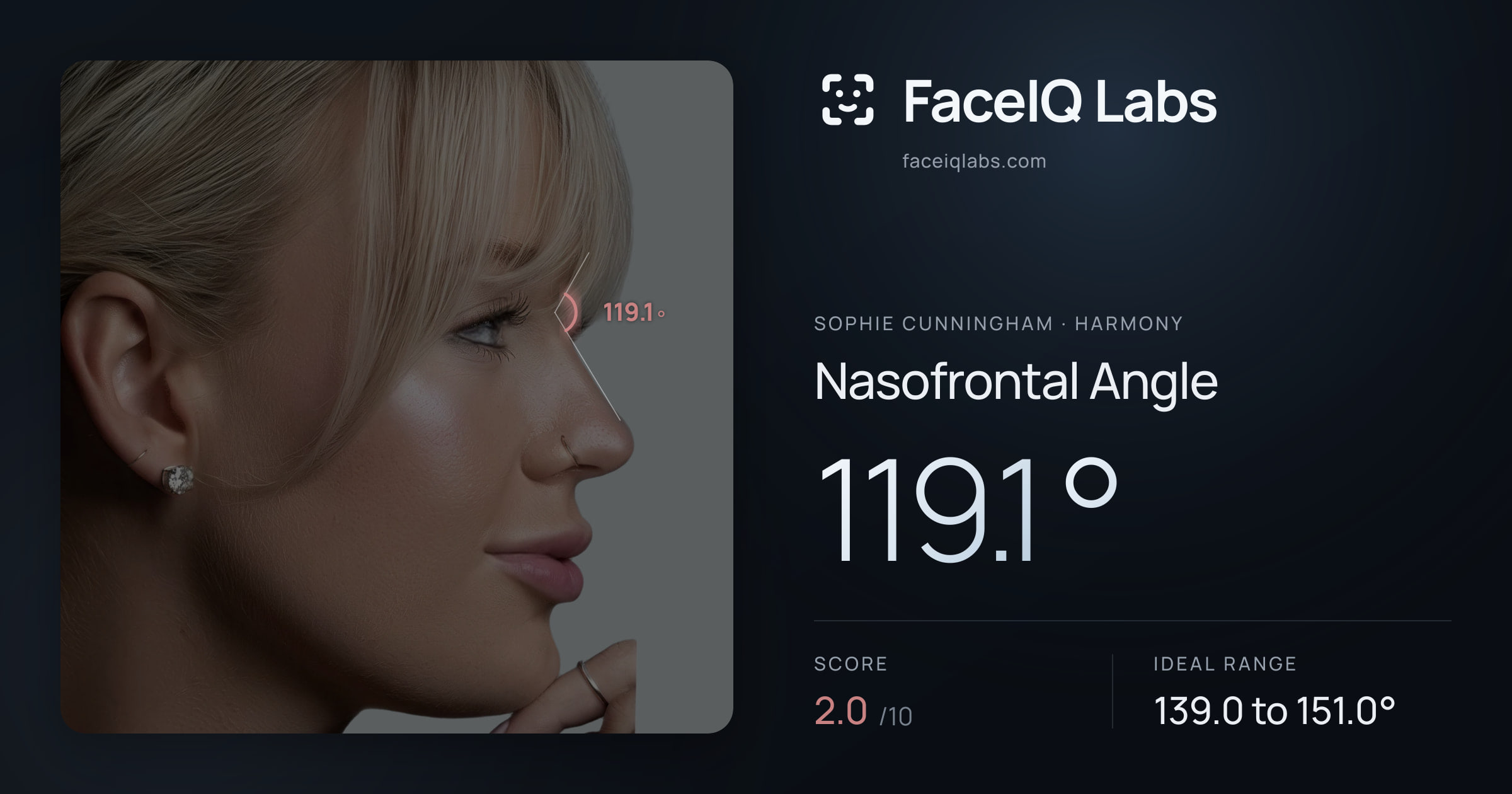 Sophie Cunningham Nasofrontal Angle: 119.1°, drawn on the photo