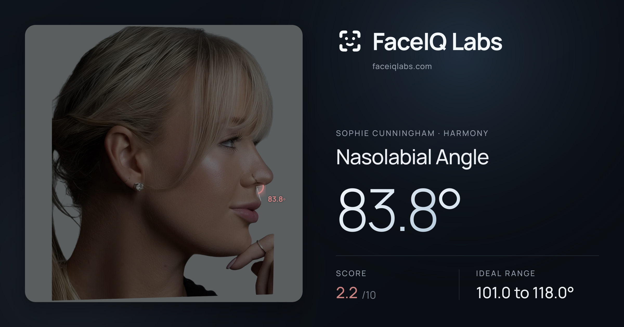 Sophie Cunningham Nasolabial Angle: 83.8°, drawn on the photo