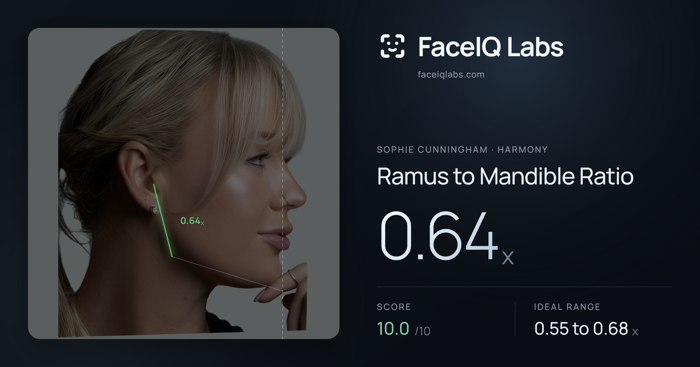 Sophie Cunningham Ramus to Mandible Ratio: 0.64x, drawn on the photo