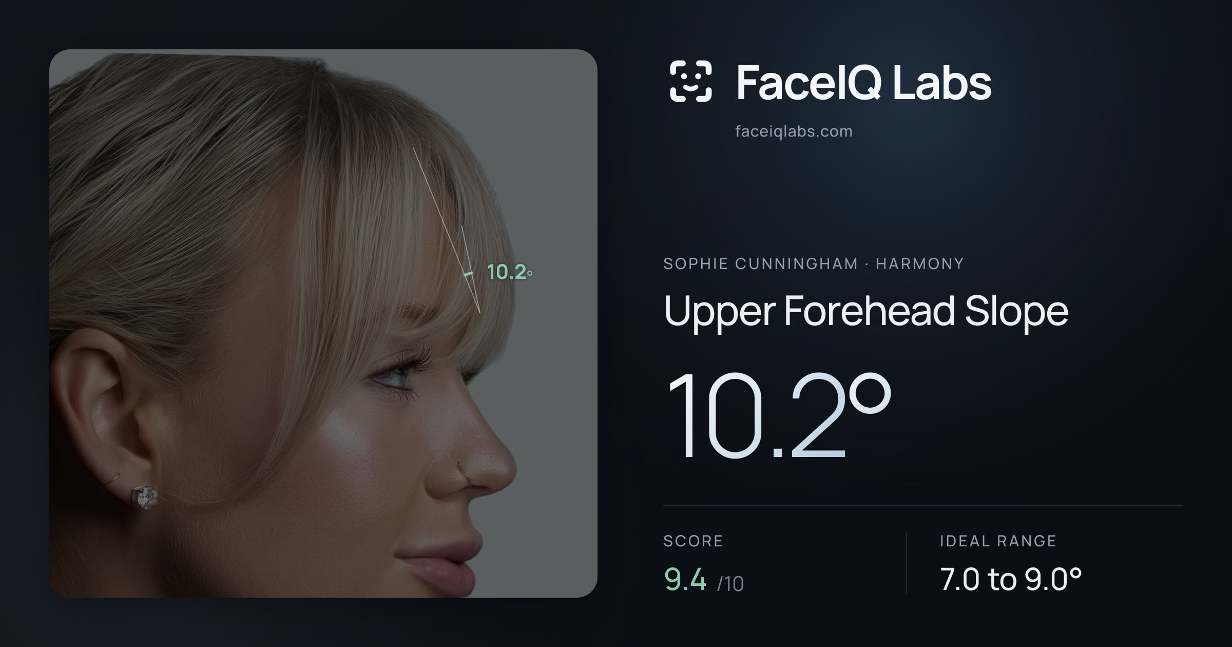 Sophie Cunningham Upper Forehead Slope: 10.2°, drawn on the photo