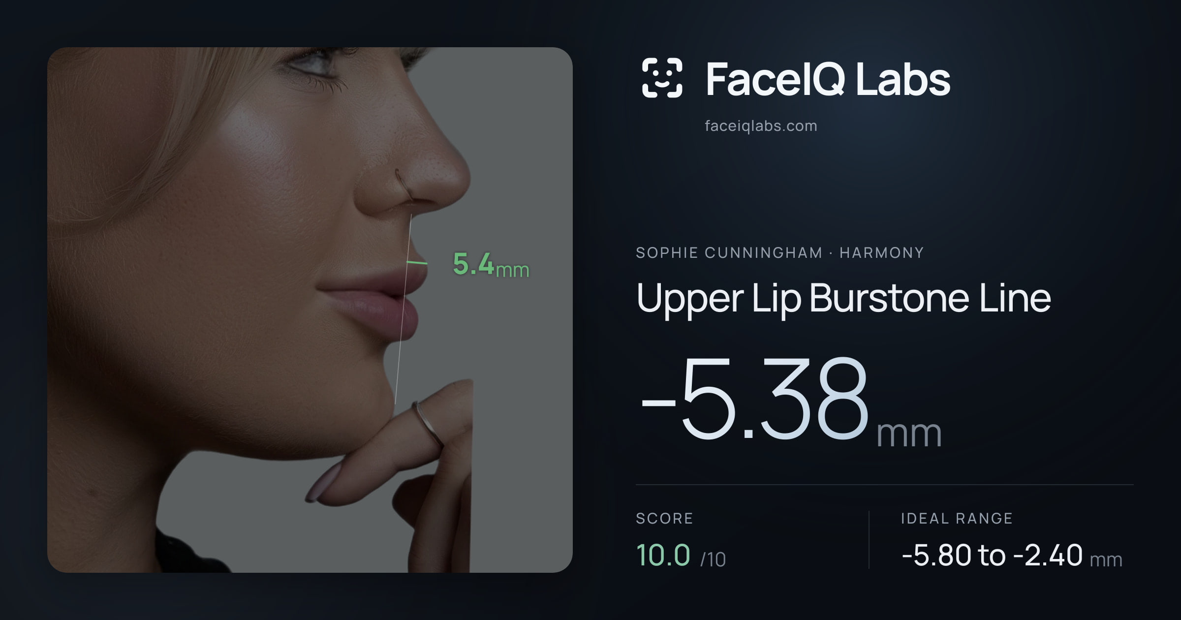 Sophie Cunningham Upper Lip Burstone Line: -5.38mm, drawn on the photo