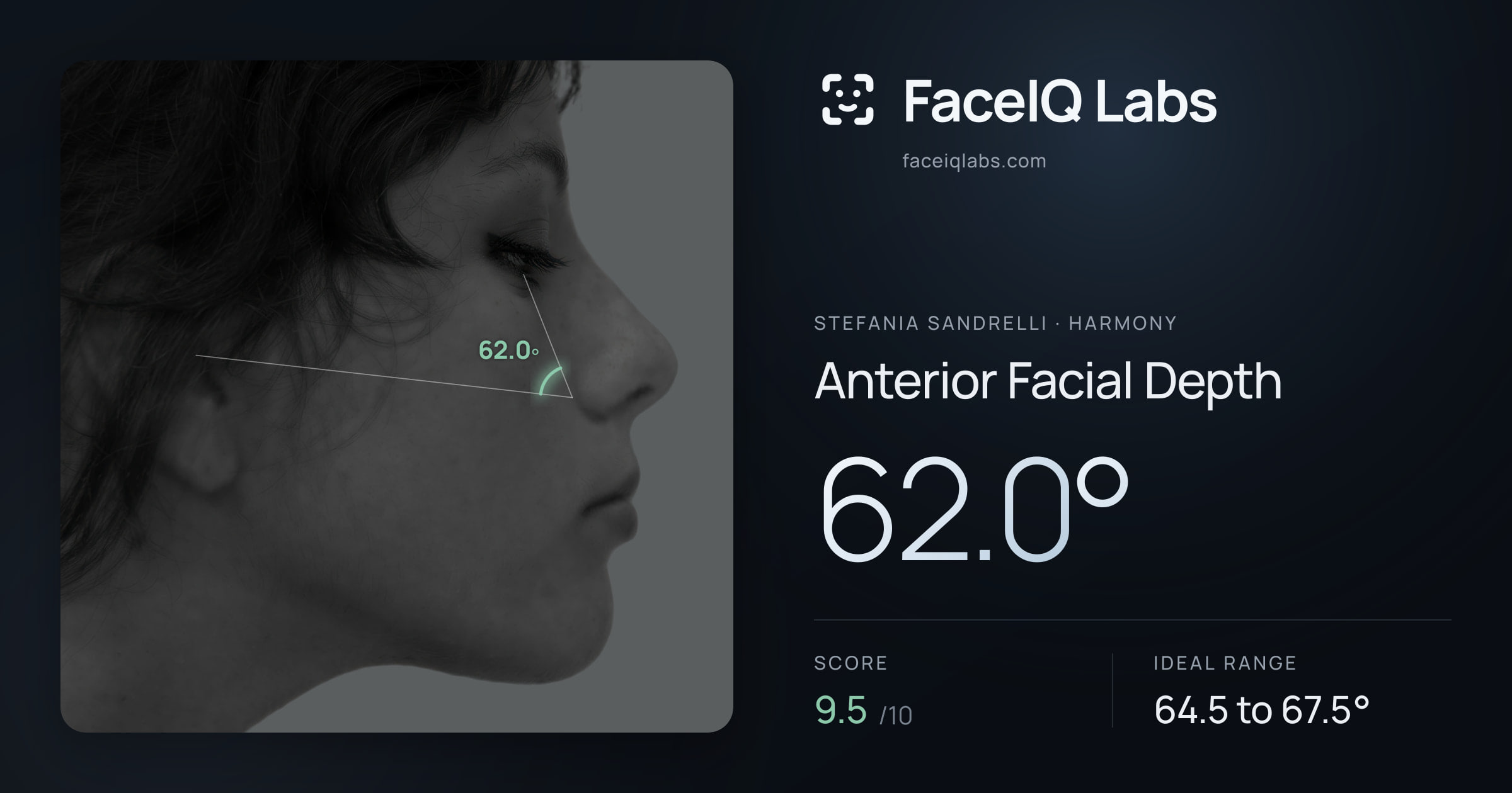 Stefania Sandrelli Anterior Facial Depth: 62.0°, drawn on the photo