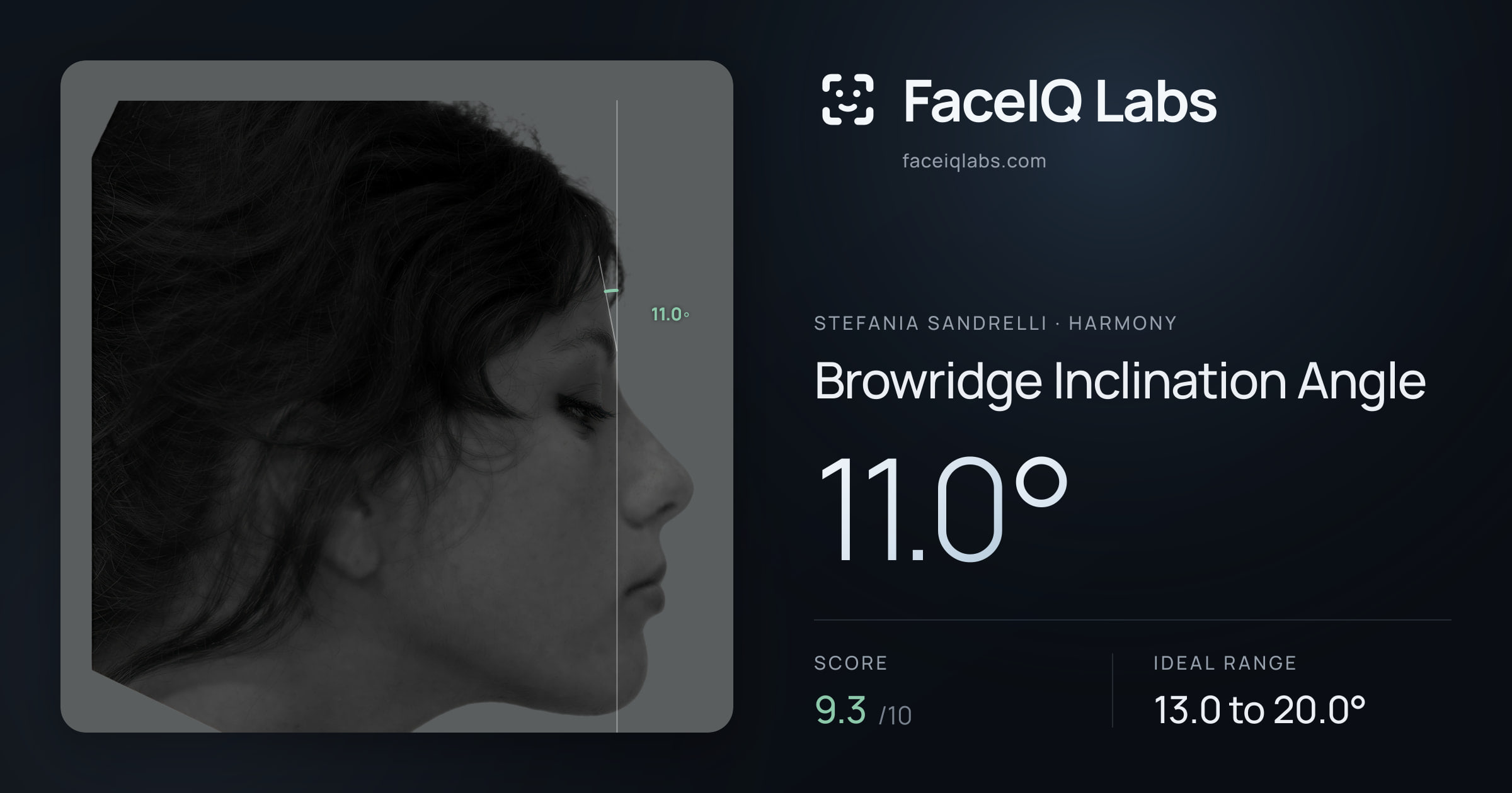 Stefania Sandrelli Browridge Inclination Angle: 11.0°, drawn on the photo