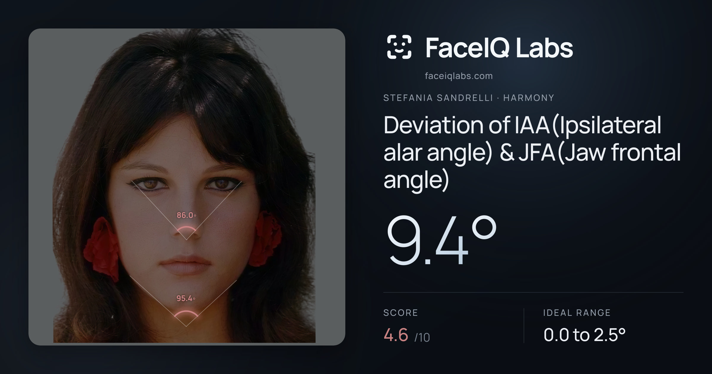 Stefania Sandrelli Deviation of IAA(Ipsilateral alar angle) & JFA(Jaw frontal angle): 9.4°, drawn on the photo
