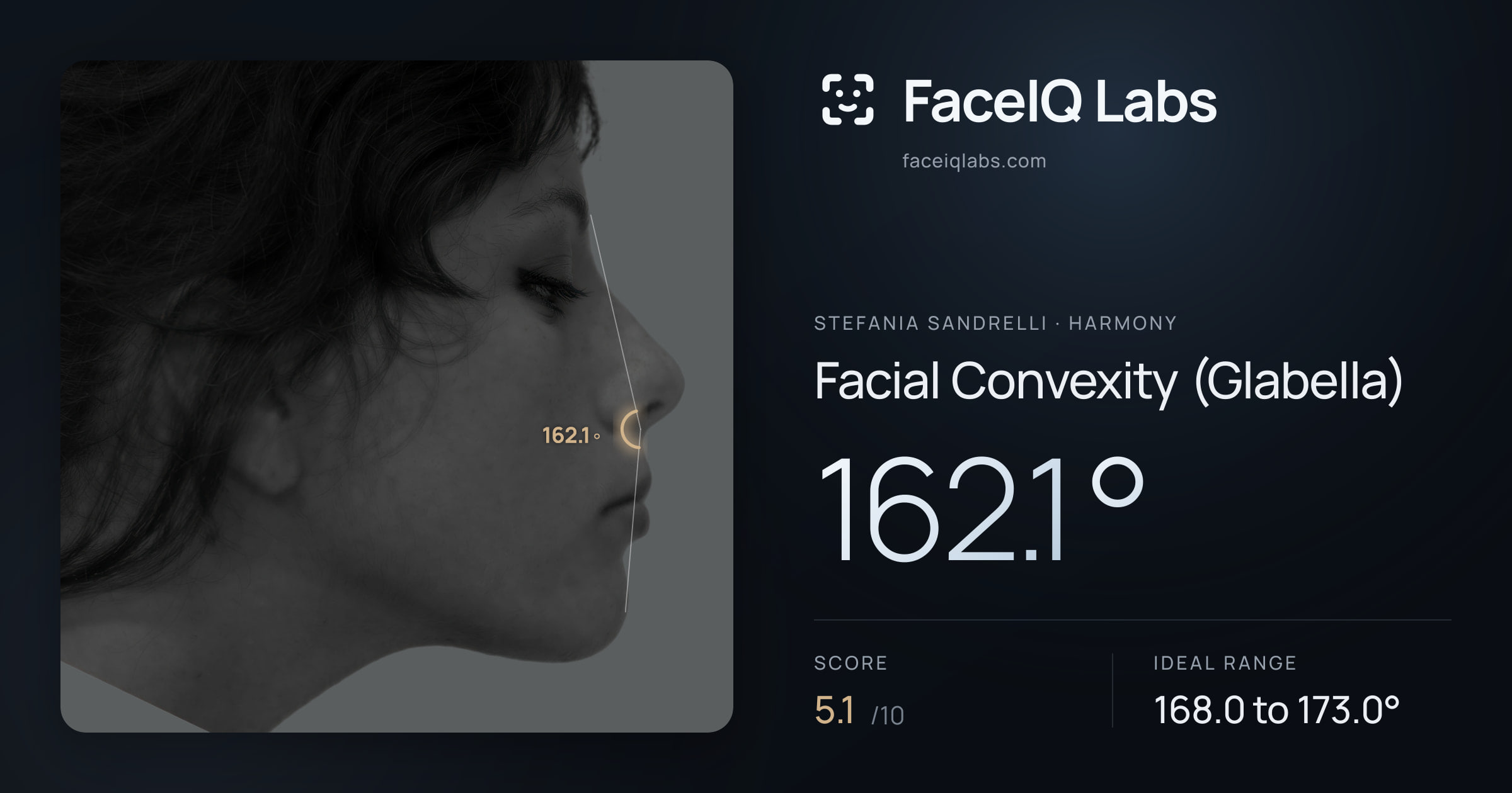 Stefania Sandrelli Facial Convexity (Glabella): 162.1°, drawn on the photo