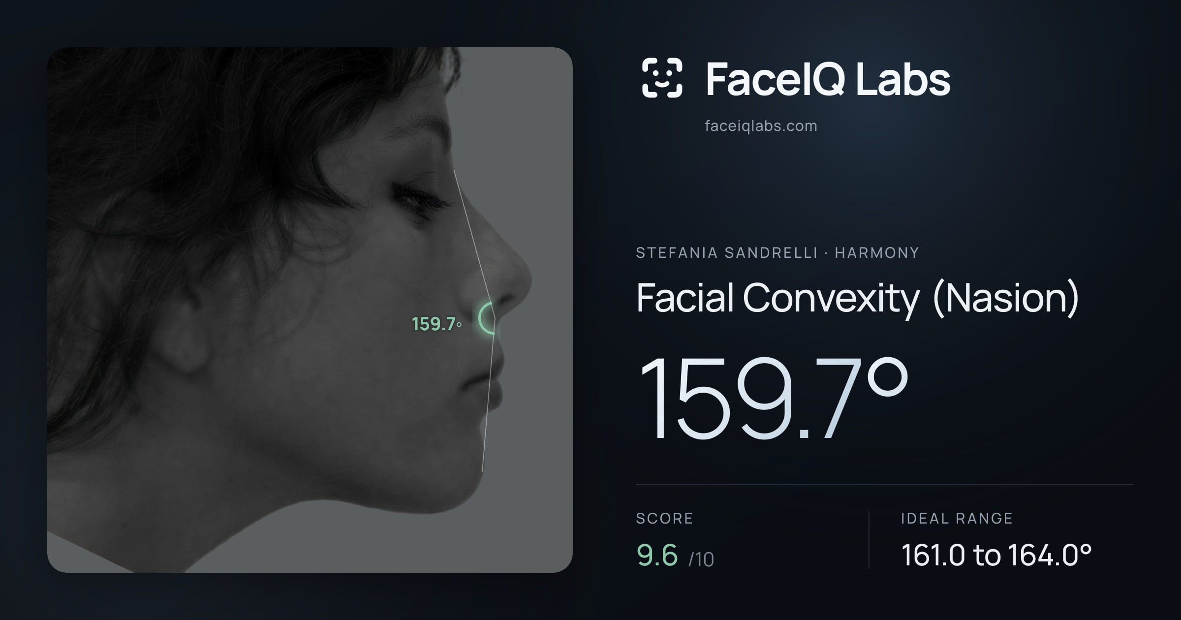 Stefania Sandrelli Facial Convexity (Nasion): 159.7°, drawn on the photo