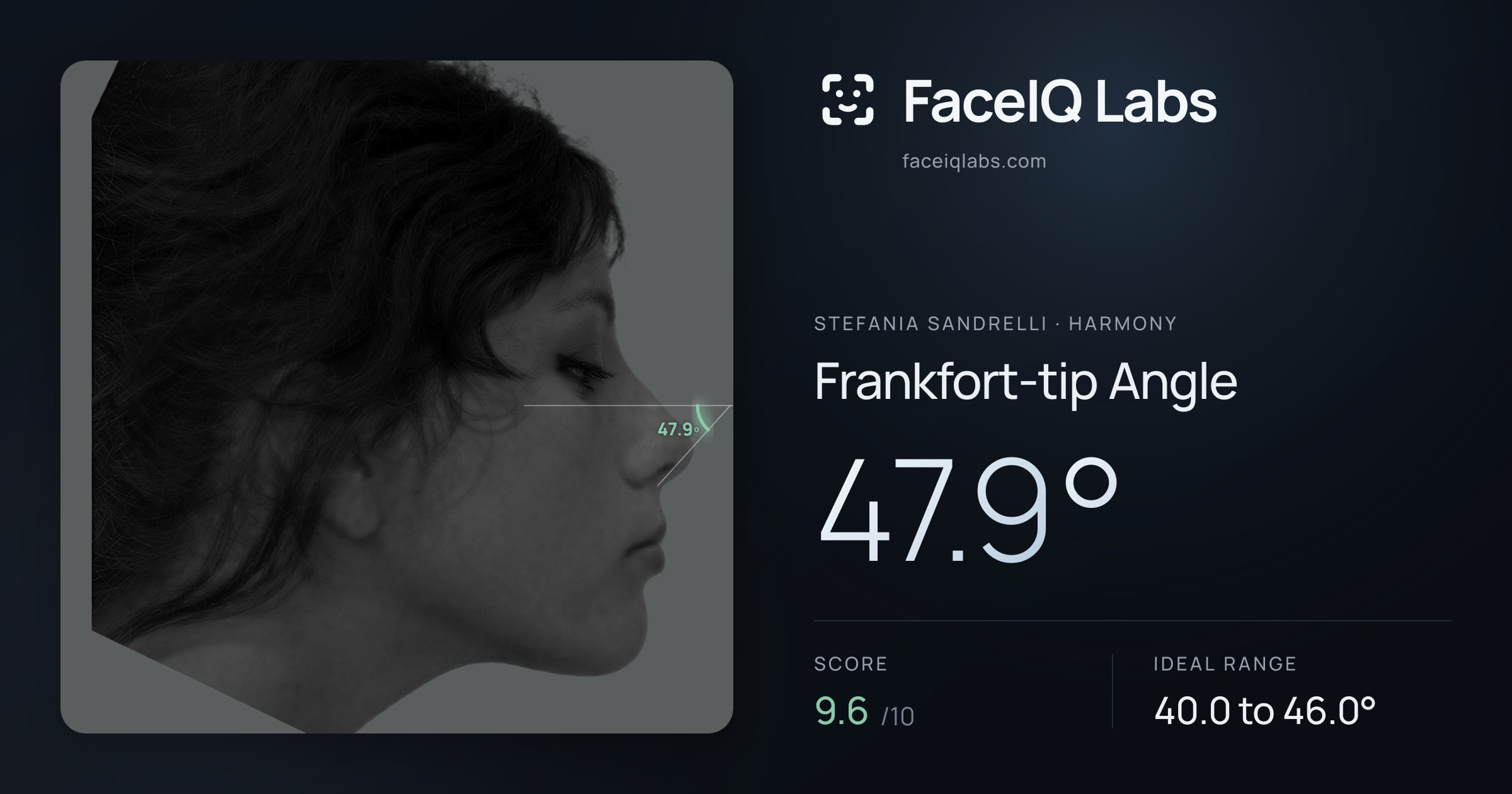 Stefania Sandrelli Frankfort-tip Angle: 47.9°, drawn on the photo