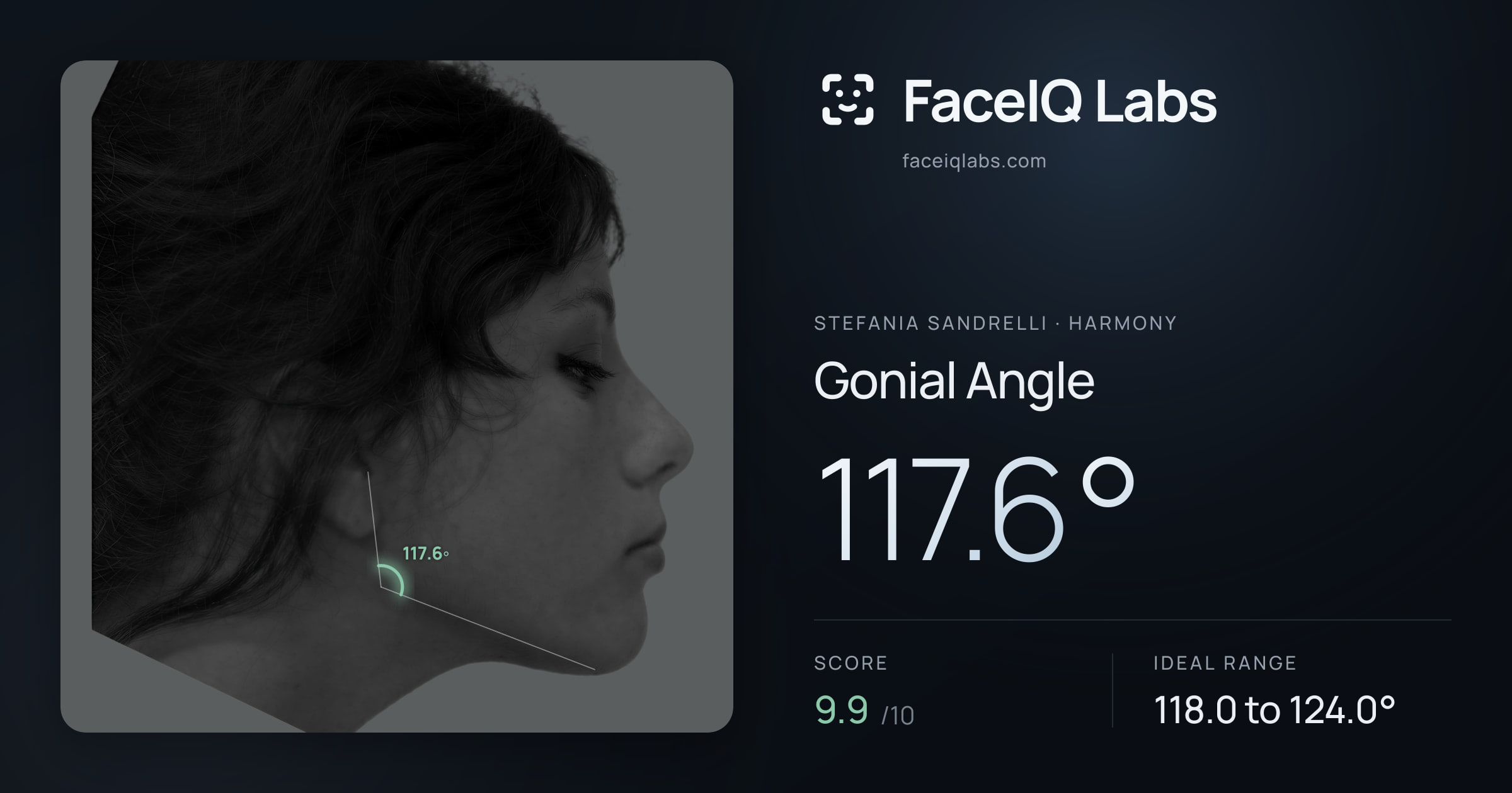 Stefania Sandrelli Gonial Angle: 117.6°, drawn on the photo