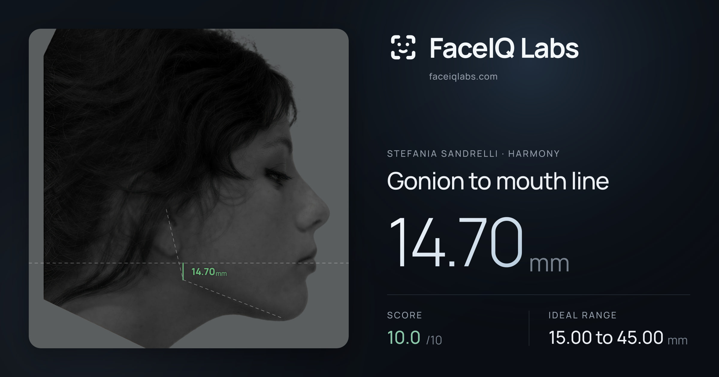 Stefania Sandrelli Gonion to mouth line: 14.70mm, drawn on the photo