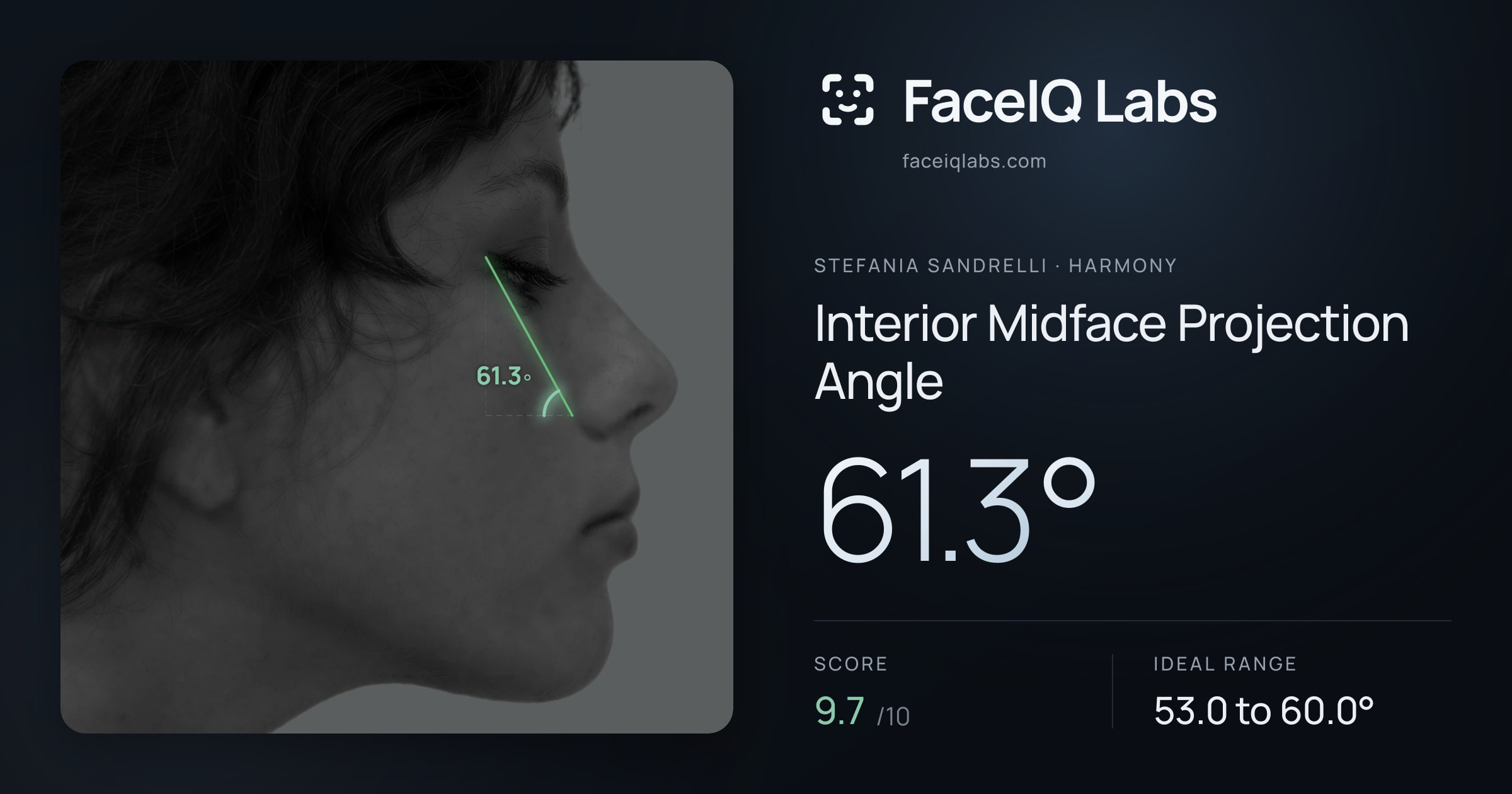 Stefania Sandrelli Interior Midface Projection Angle: 61.3°, drawn on the photo