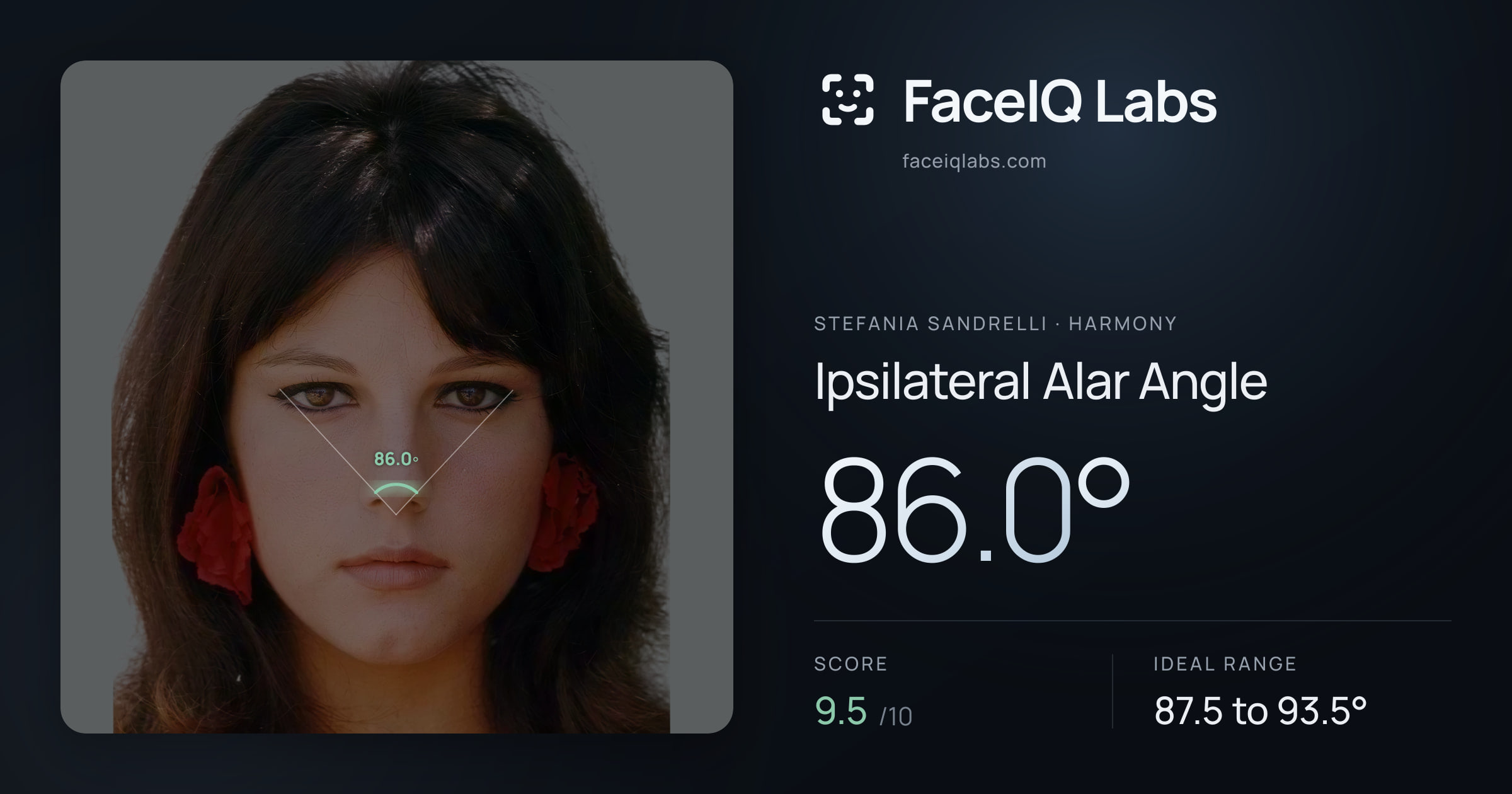Stefania Sandrelli Ipsilateral Alar Angle: 86.0°, drawn on the photo