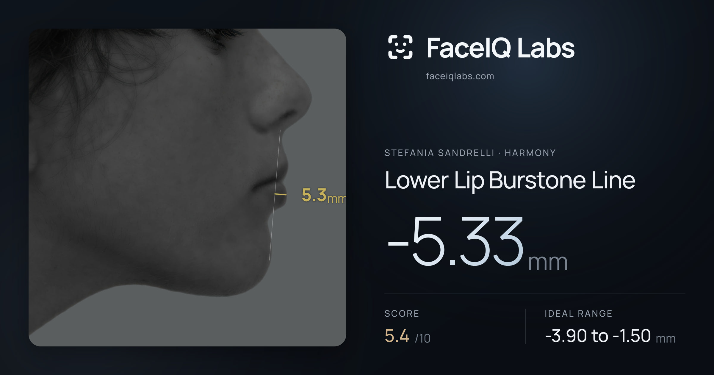 Stefania Sandrelli Lower Lip Burstone Line: -5.33mm, drawn on the photo
