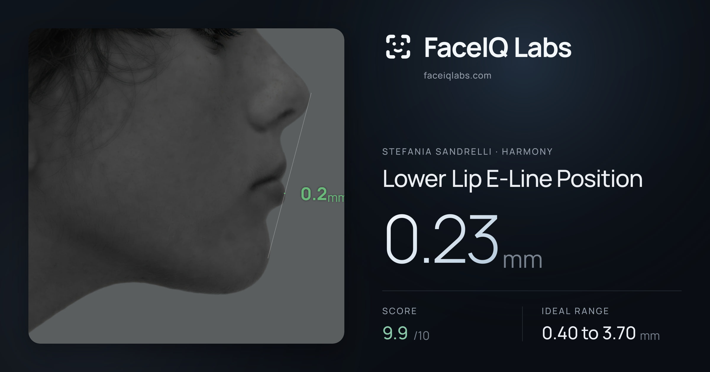 Stefania Sandrelli Lower Lip E-Line Position: 0.23mm, drawn on the photo