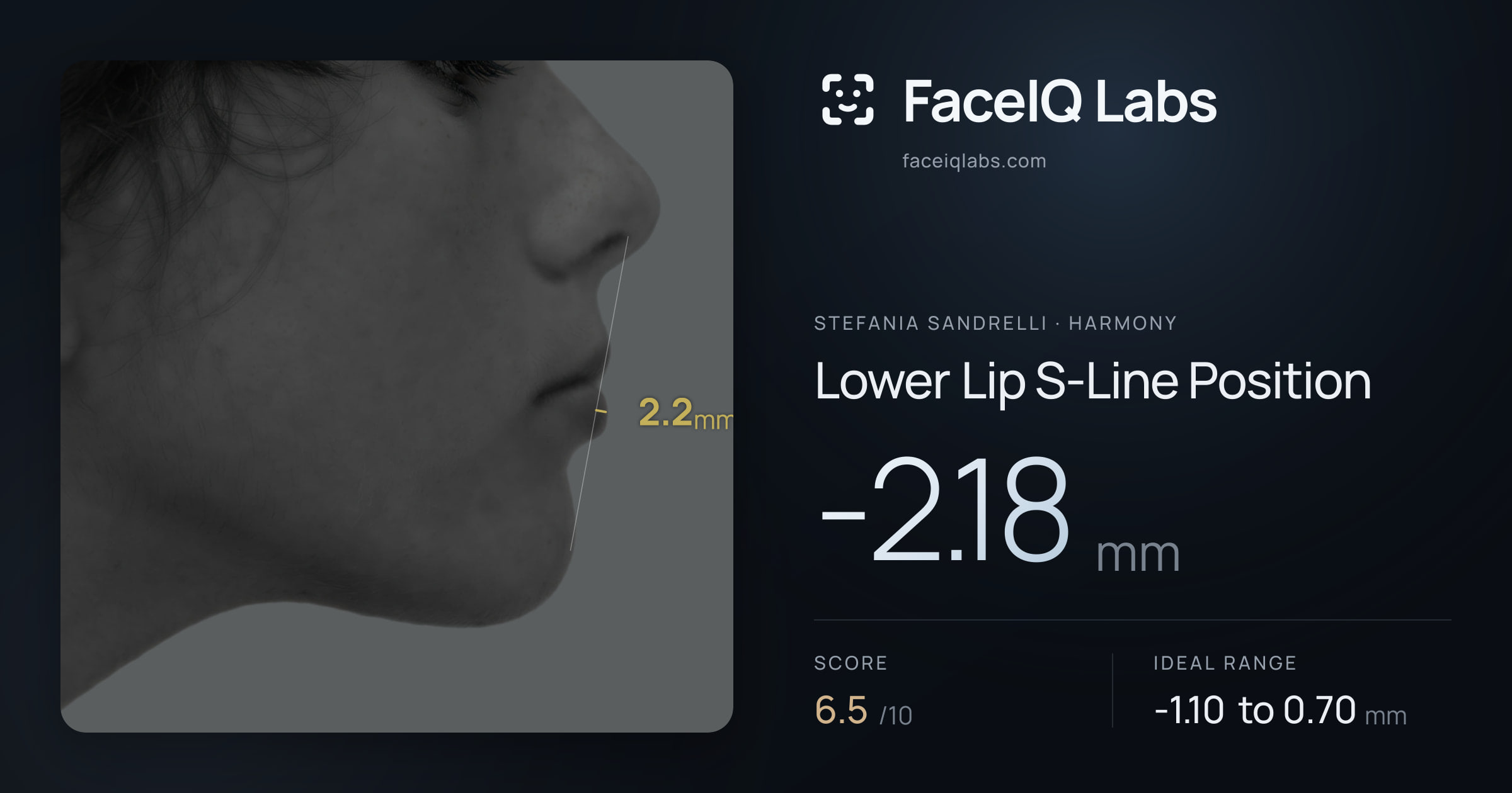 Stefania Sandrelli Lower Lip S-Line Position: -2.18mm, drawn on the photo