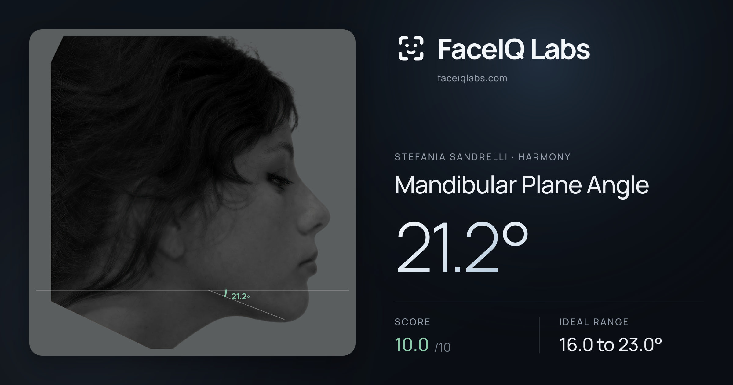 Stefania Sandrelli Mandibular Plane Angle: 21.2°, drawn on the photo