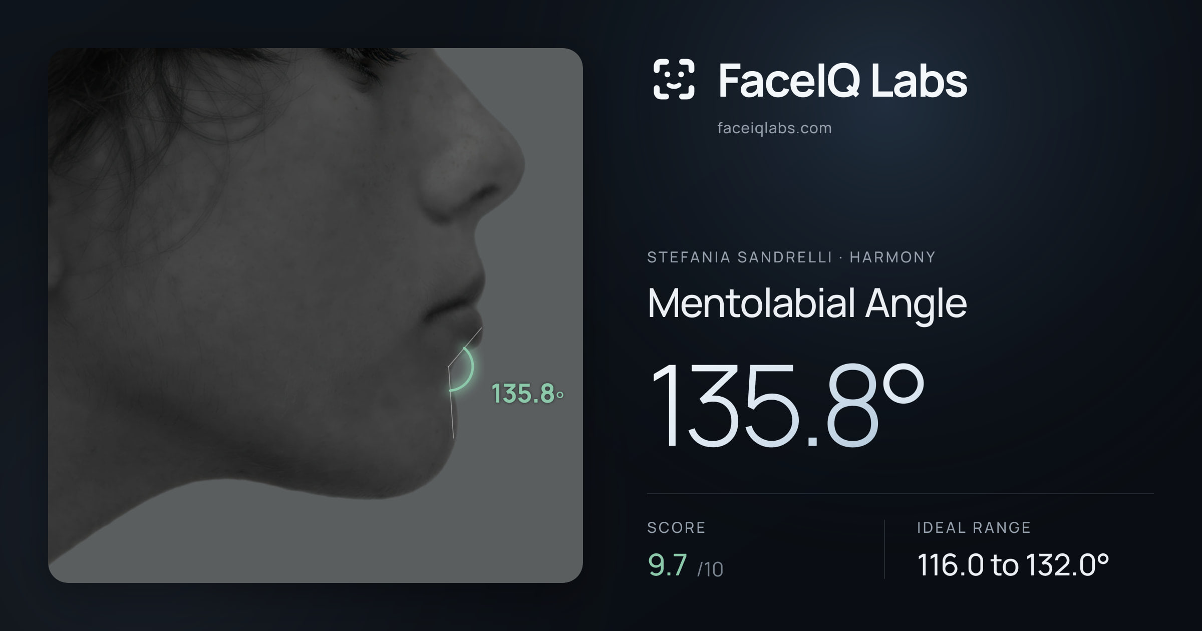 Stefania Sandrelli Mentolabial Angle: 135.8°, drawn on the photo