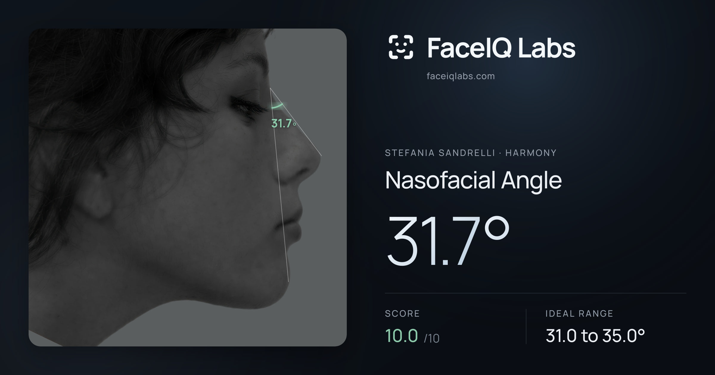 Stefania Sandrelli Nasofacial Angle: 31.7°, drawn on the photo