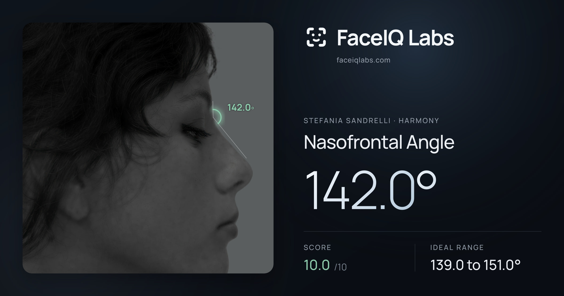 Stefania Sandrelli Nasofrontal Angle: 142.0°, drawn on the photo