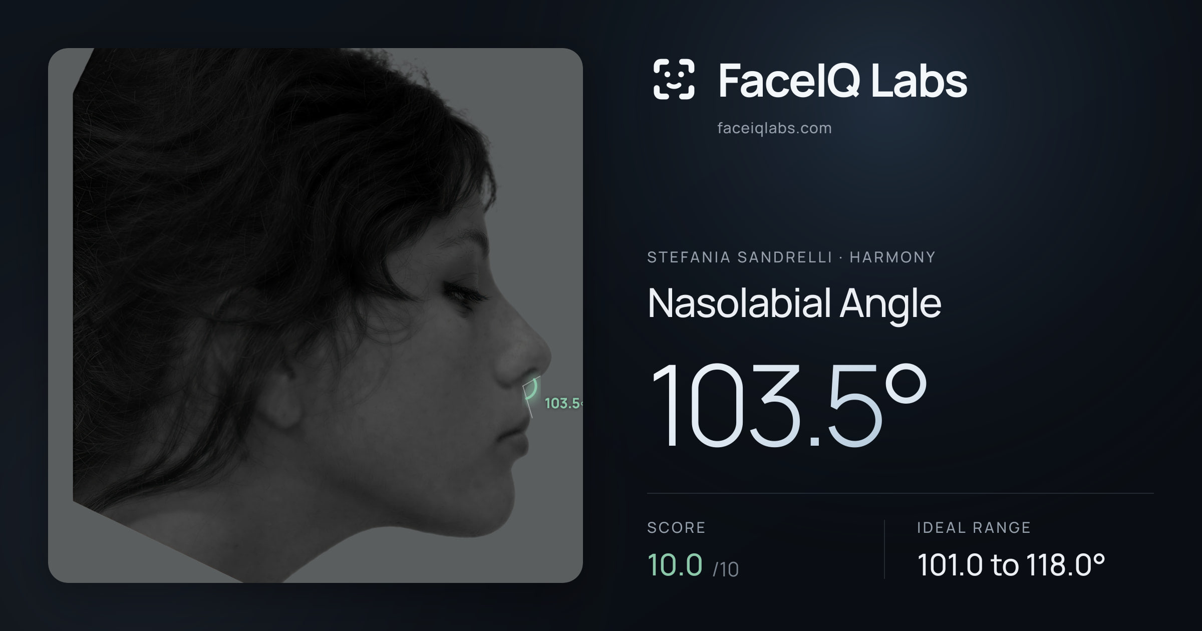 Stefania Sandrelli Nasolabial Angle: 103.5°, drawn on the photo