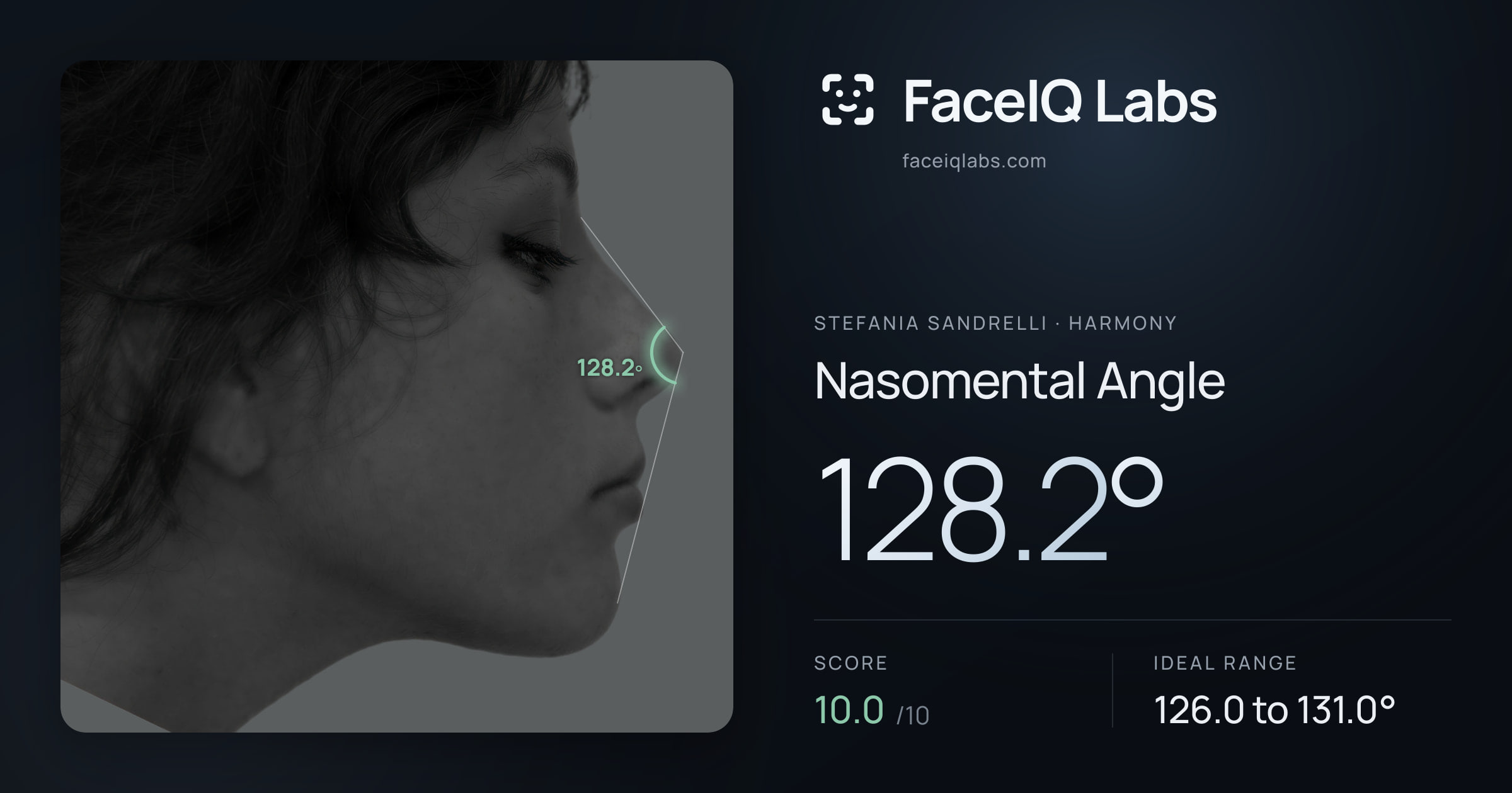 Stefania Sandrelli Nasomental Angle: 128.2°, drawn on the photo