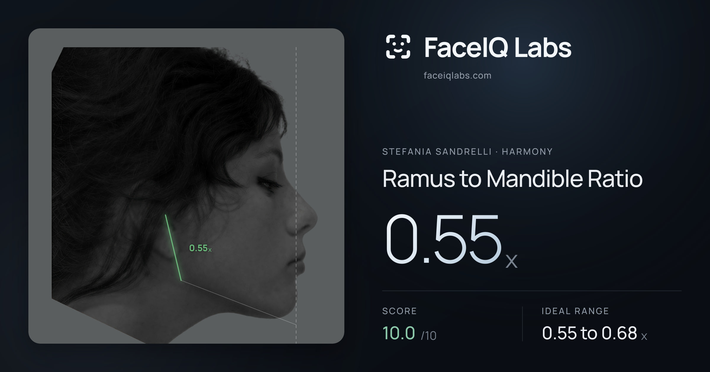 Stefania Sandrelli Ramus to Mandible Ratio: 0.55x, drawn on the photo