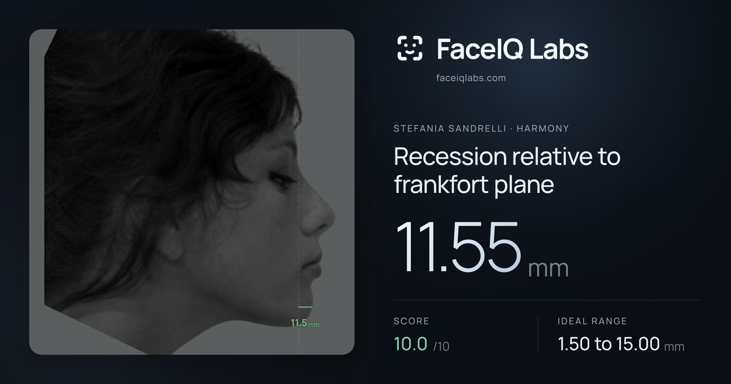 Stefania Sandrelli Recession relative to frankfort plane: 11.55mm, drawn on the photo