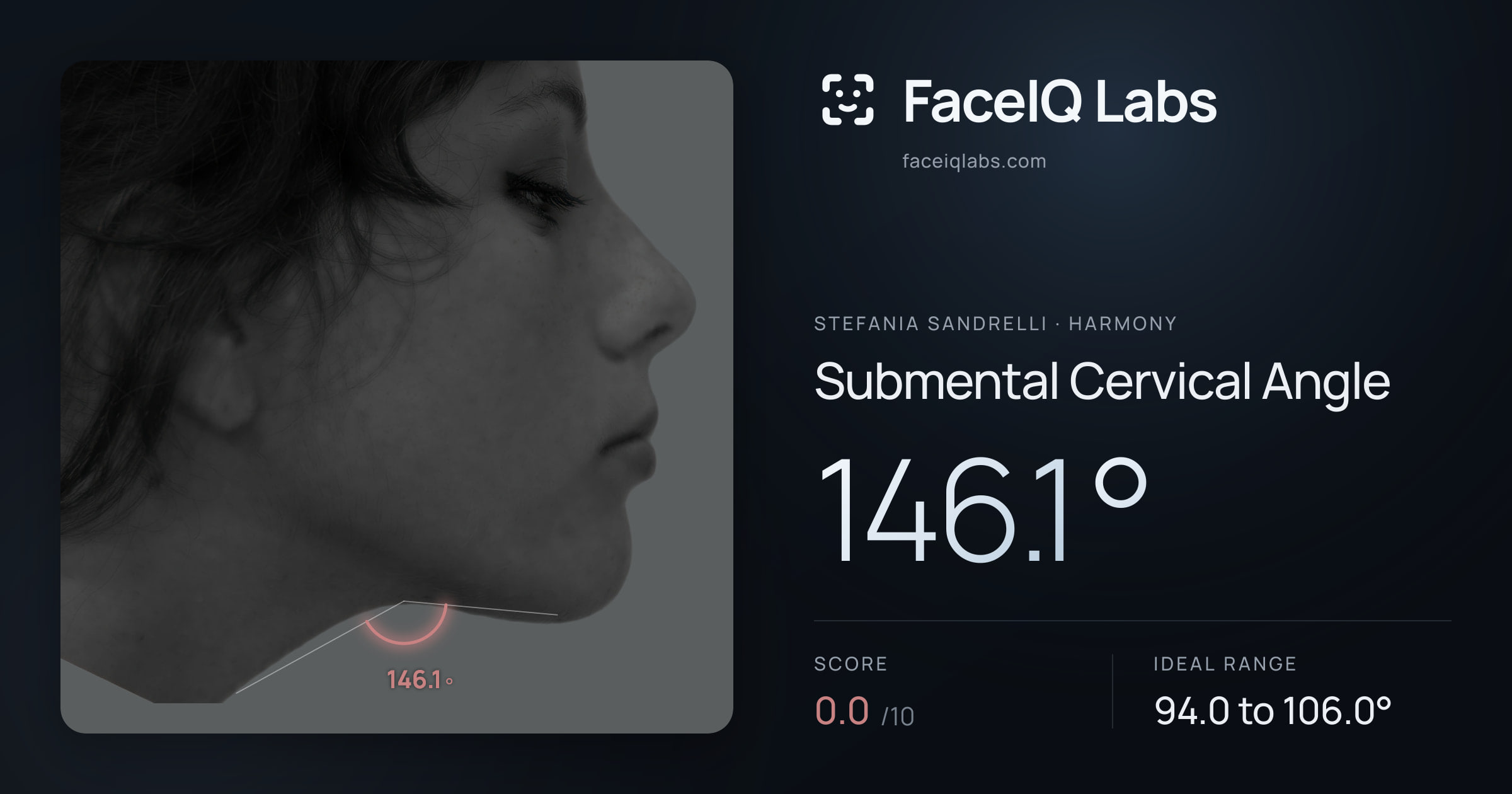 Stefania Sandrelli Submental Cervical Angle: 146.1°, drawn on the photo
