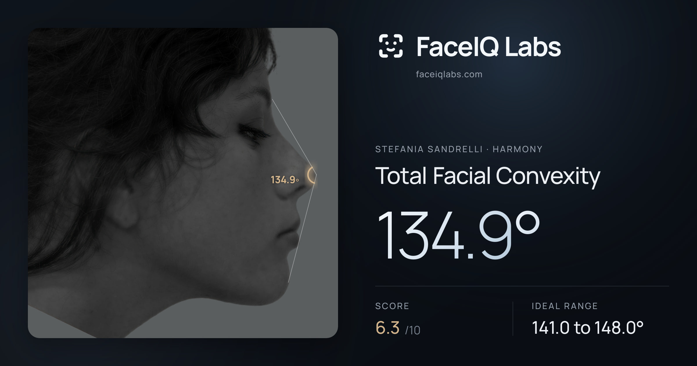 Stefania Sandrelli Total Facial Convexity: 134.9°, drawn on the photo