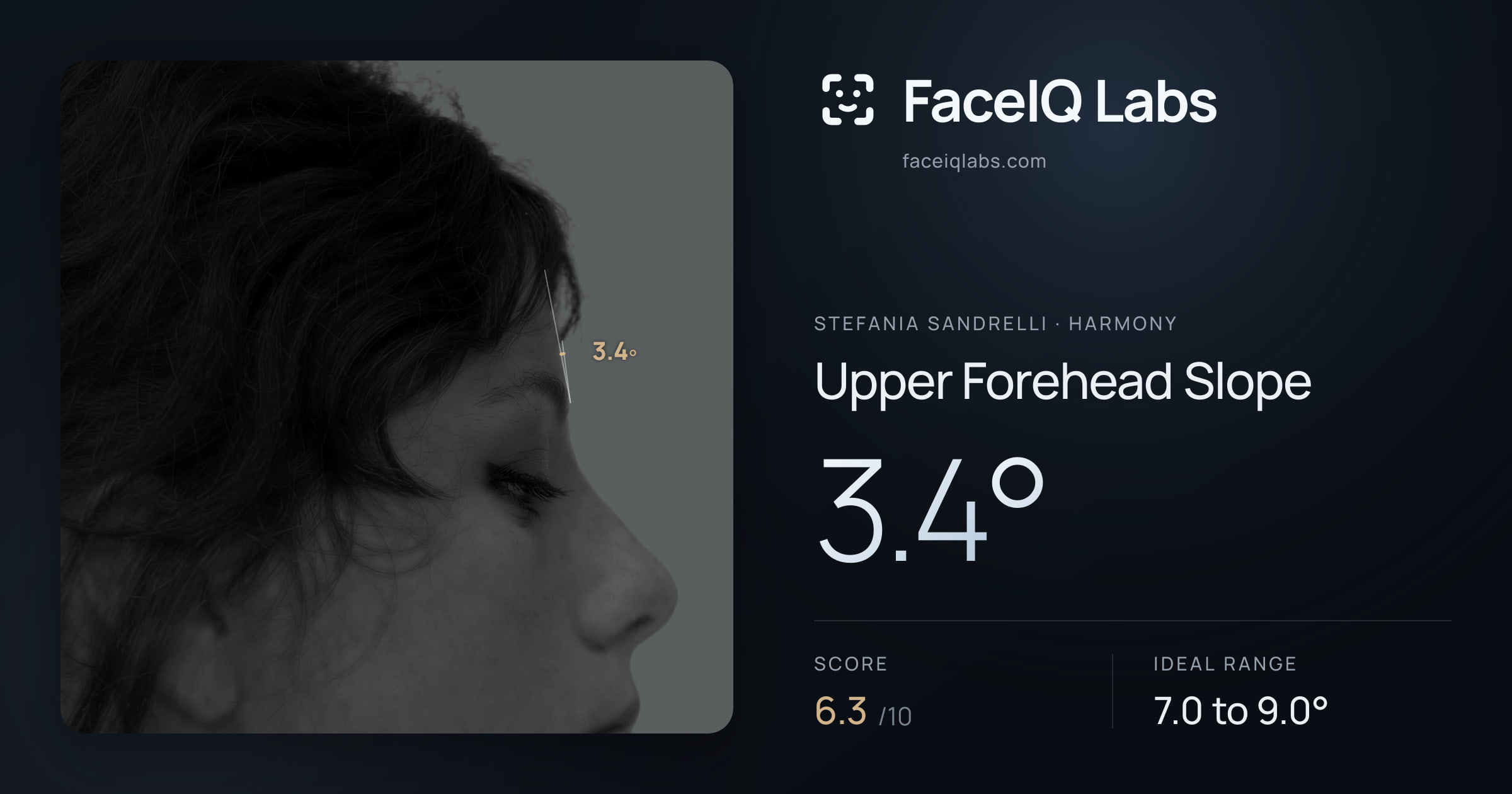 Stefania Sandrelli Upper Forehead Slope: 3.4°, drawn on the photo
