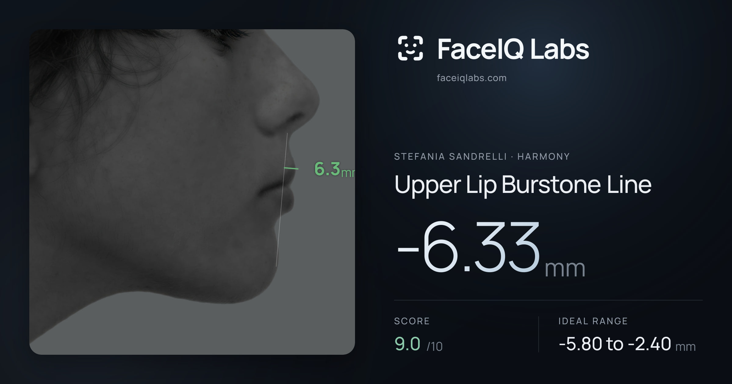 Stefania Sandrelli Upper Lip Burstone Line: -6.33mm, drawn on the photo